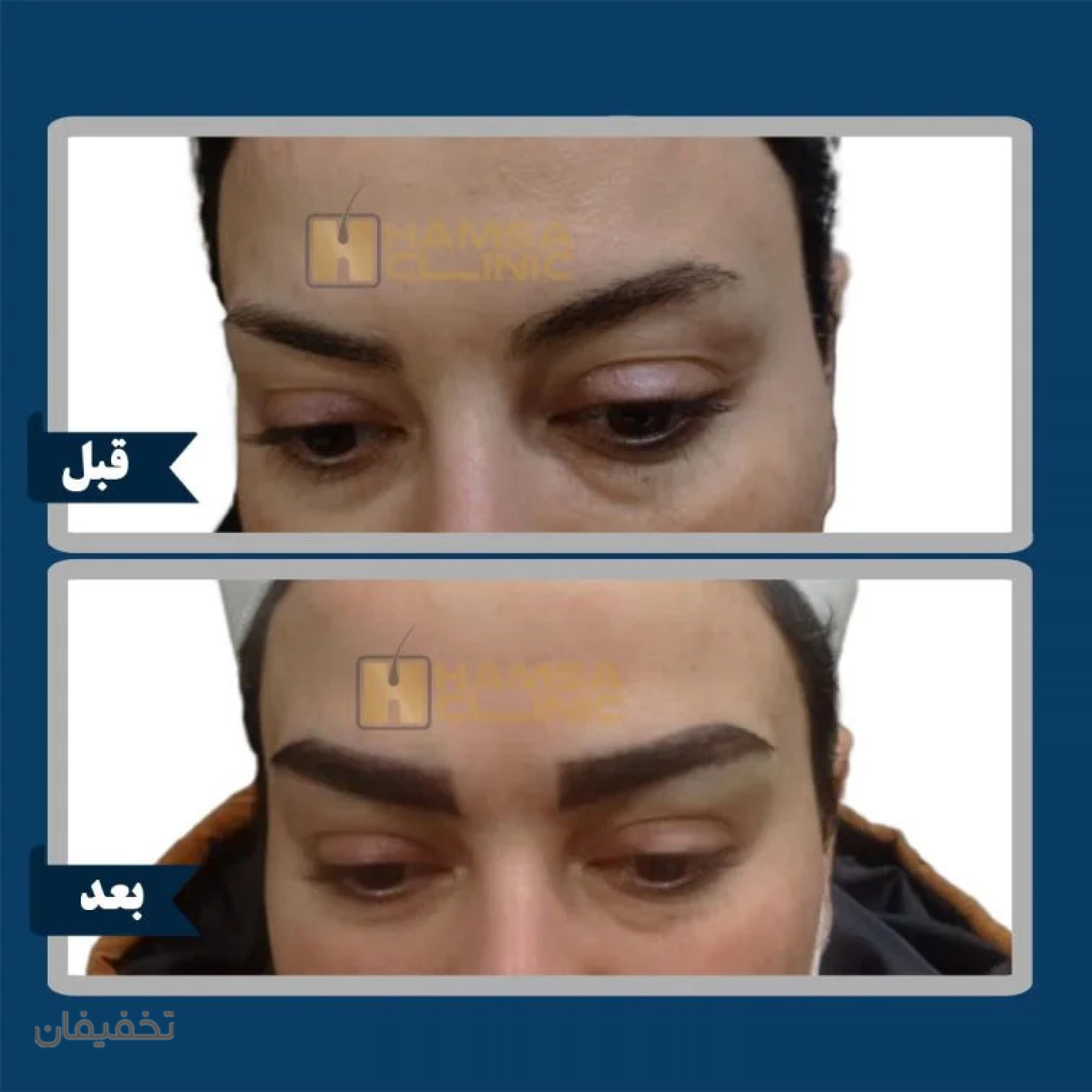 کلینیک کاشت مو و زیبایی همسا