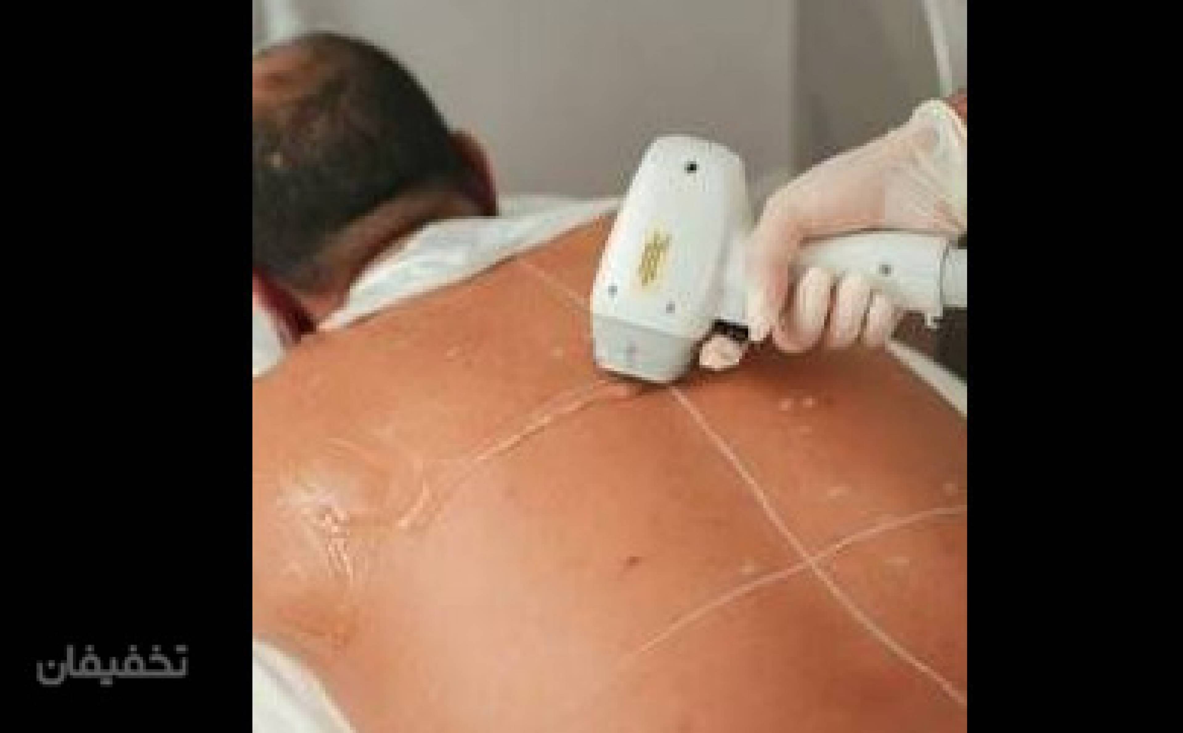 کلینیک نومو لیزر