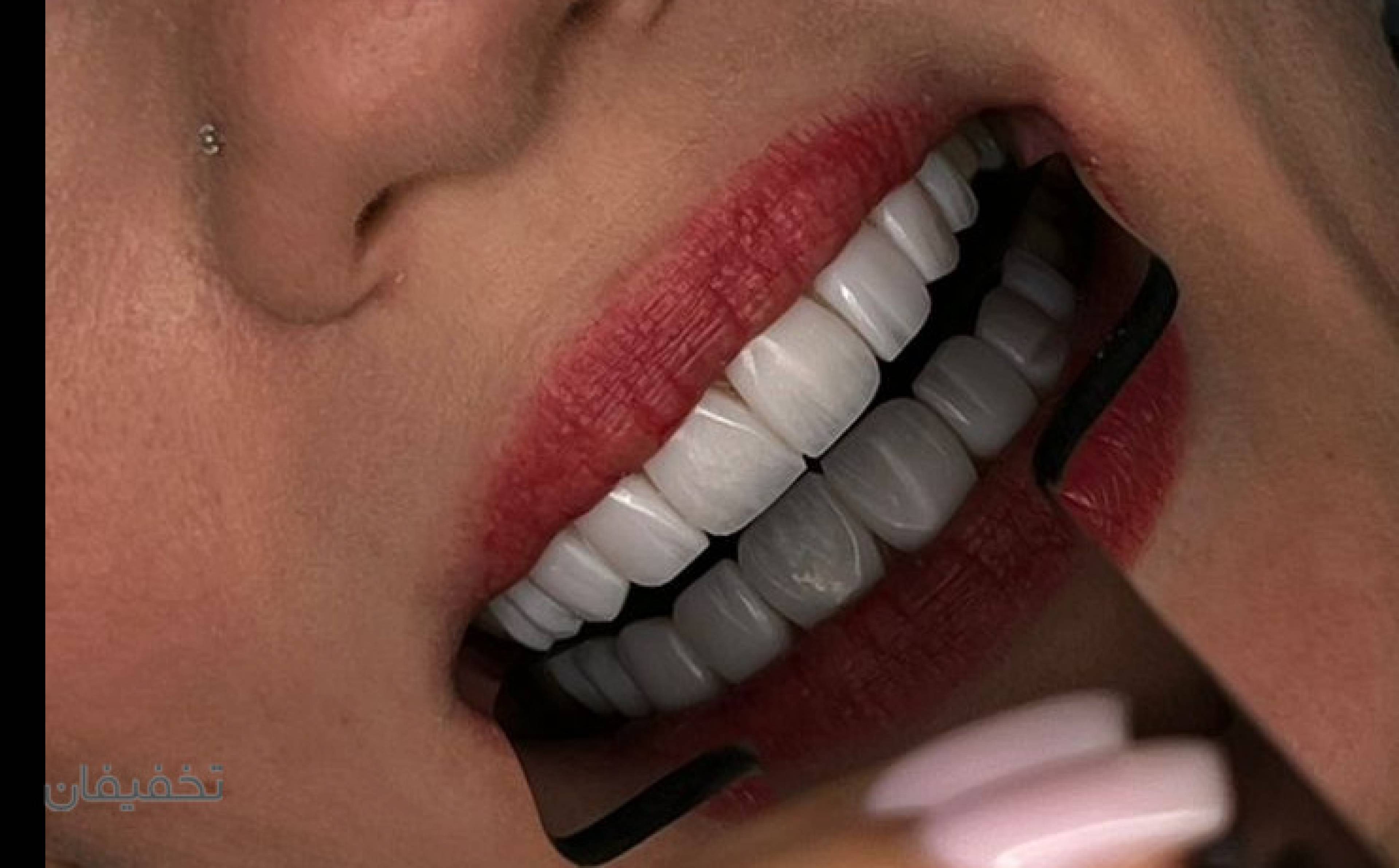 دندانپزشکی لوکا سعادت‌آباد