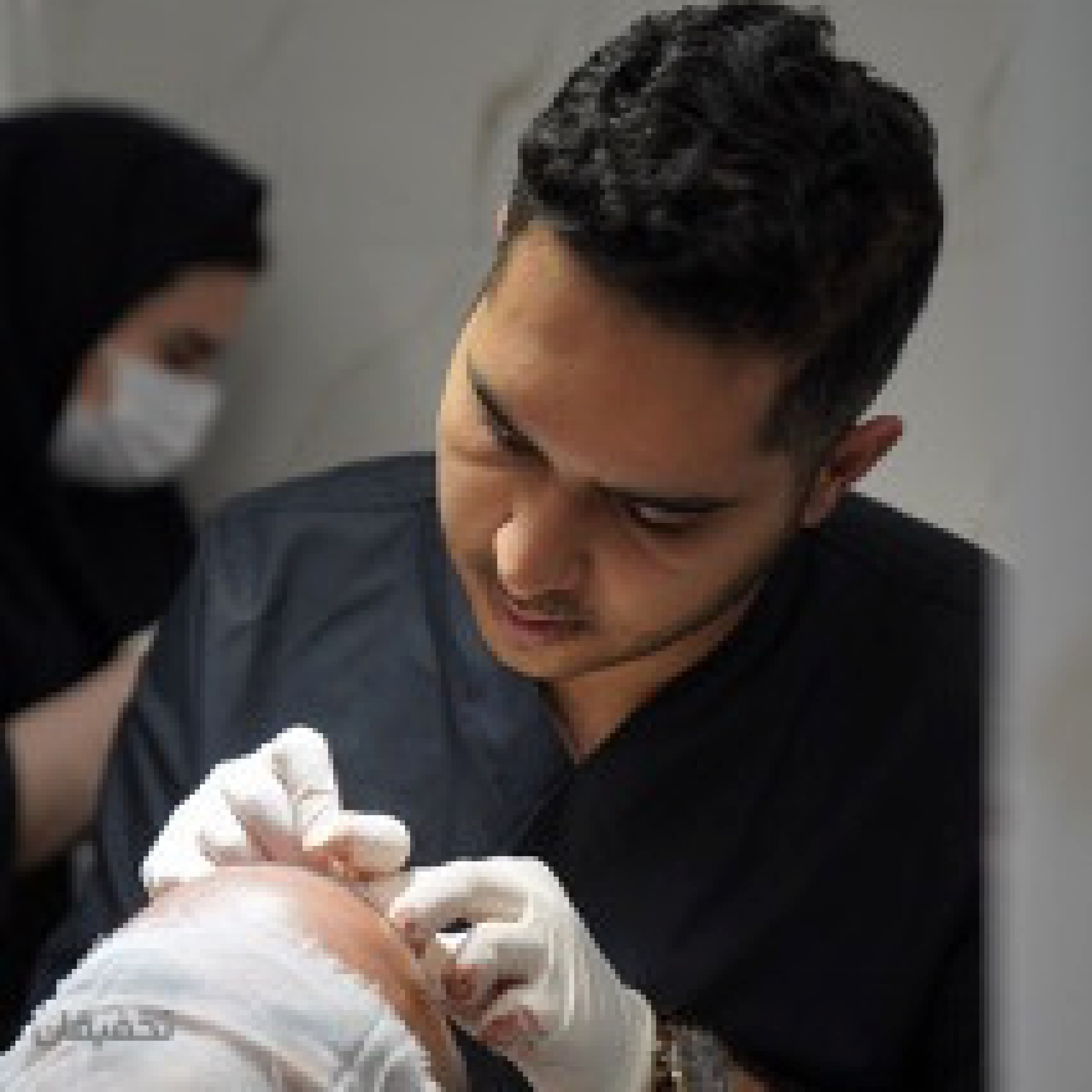 تیم کاشت مو بیوفول