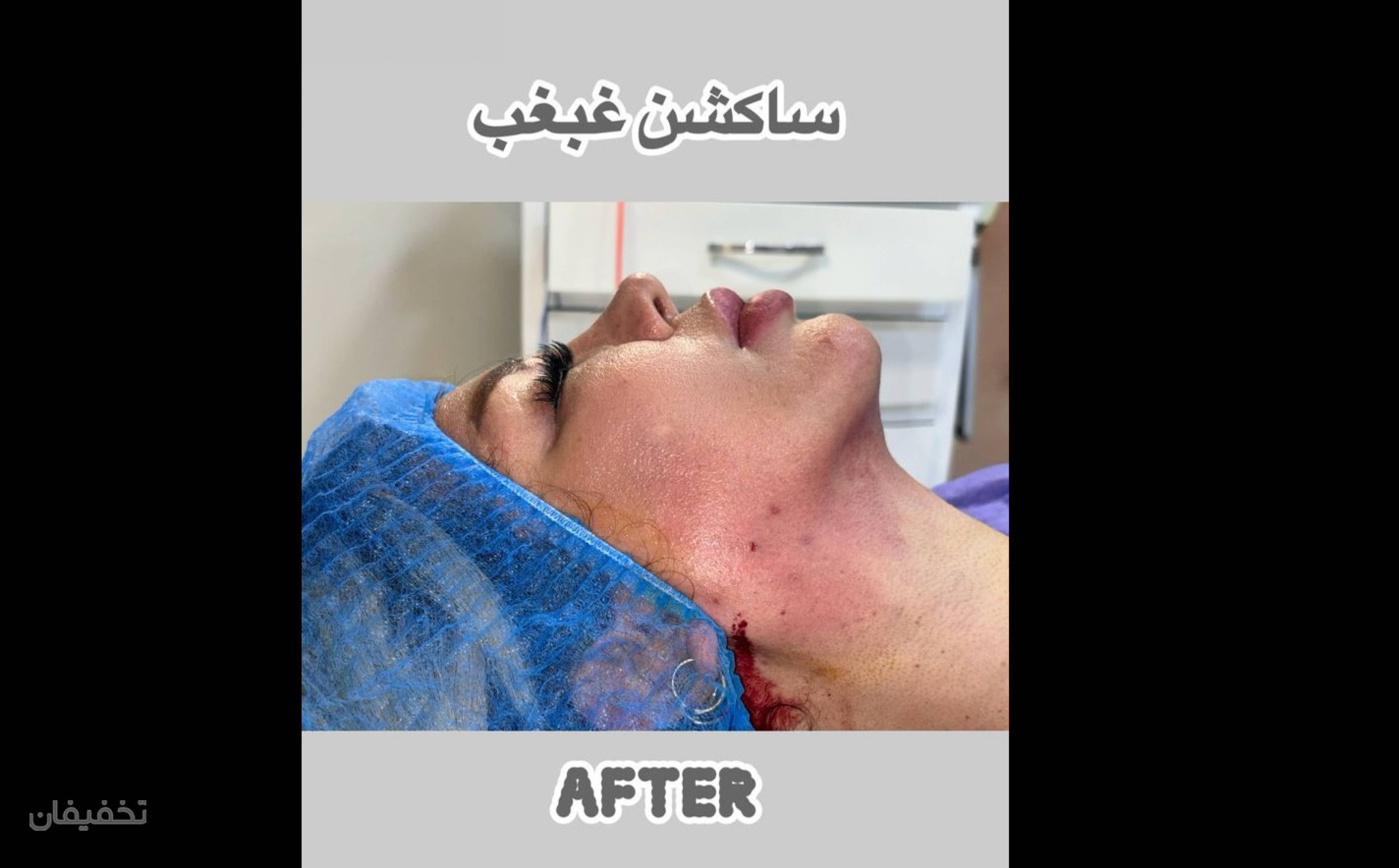مرکز جراحی زیبایی لیلیانا