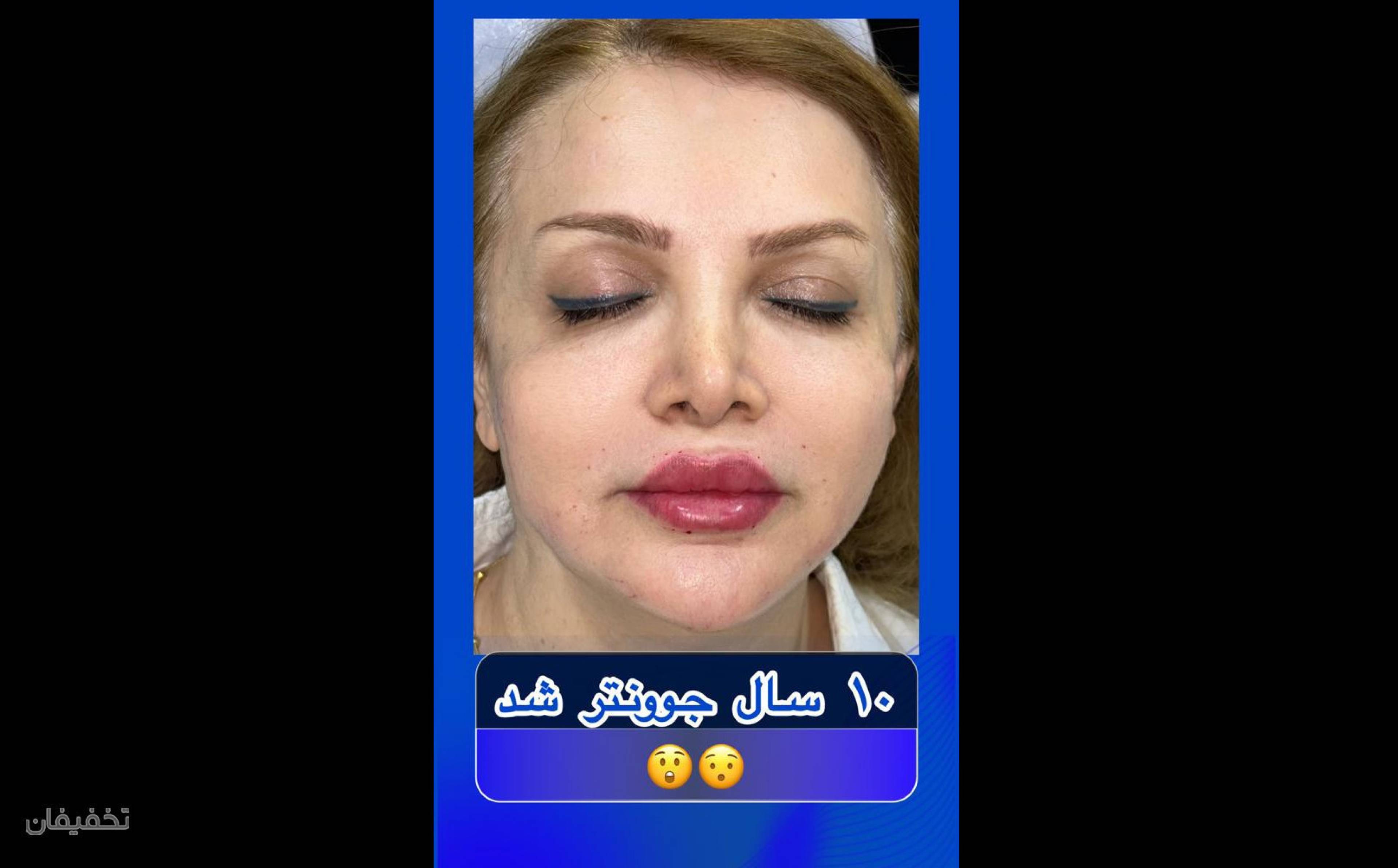 مرکز جراحی زیبایی لیلیانا