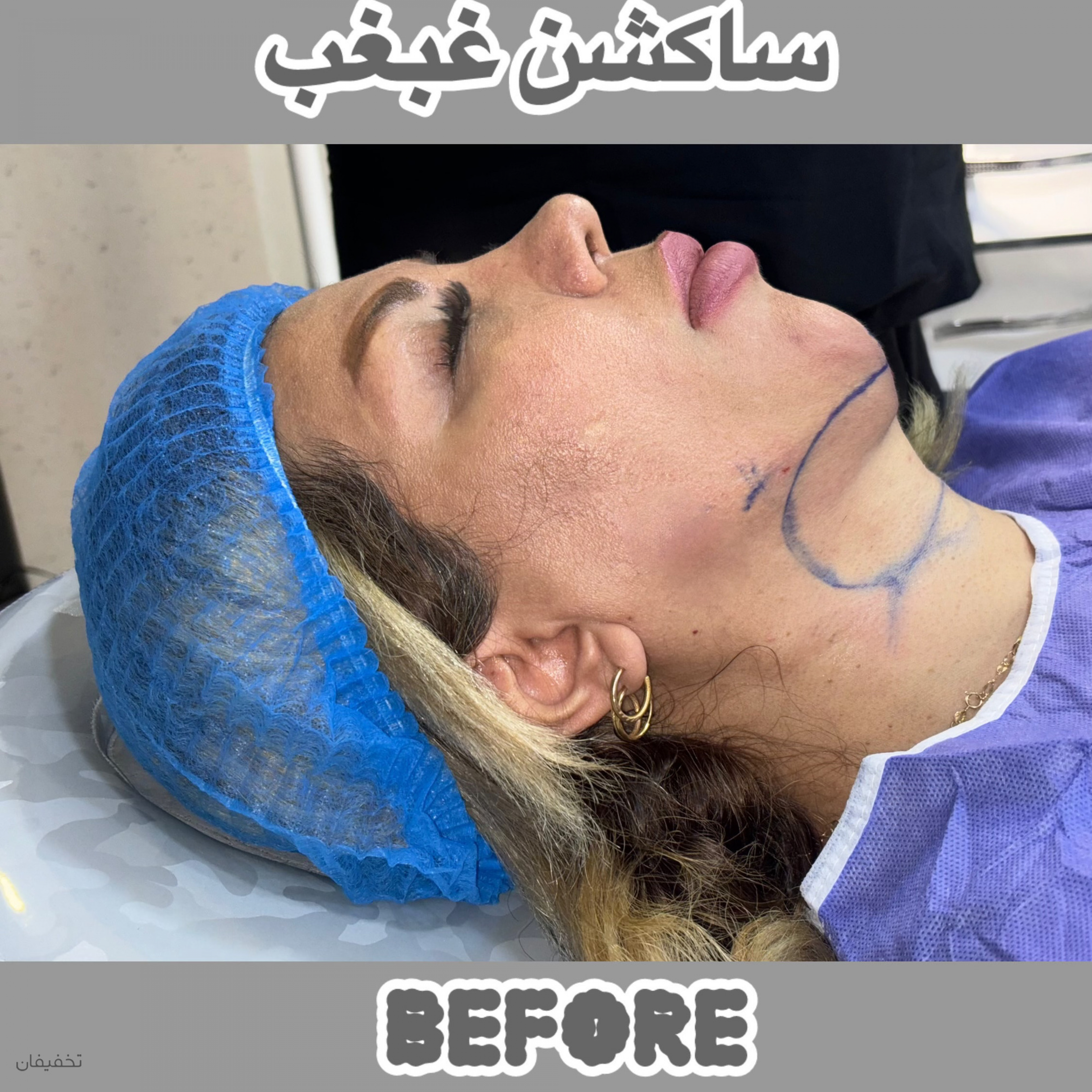 مرکز جراحی زیبایی لیلیانا