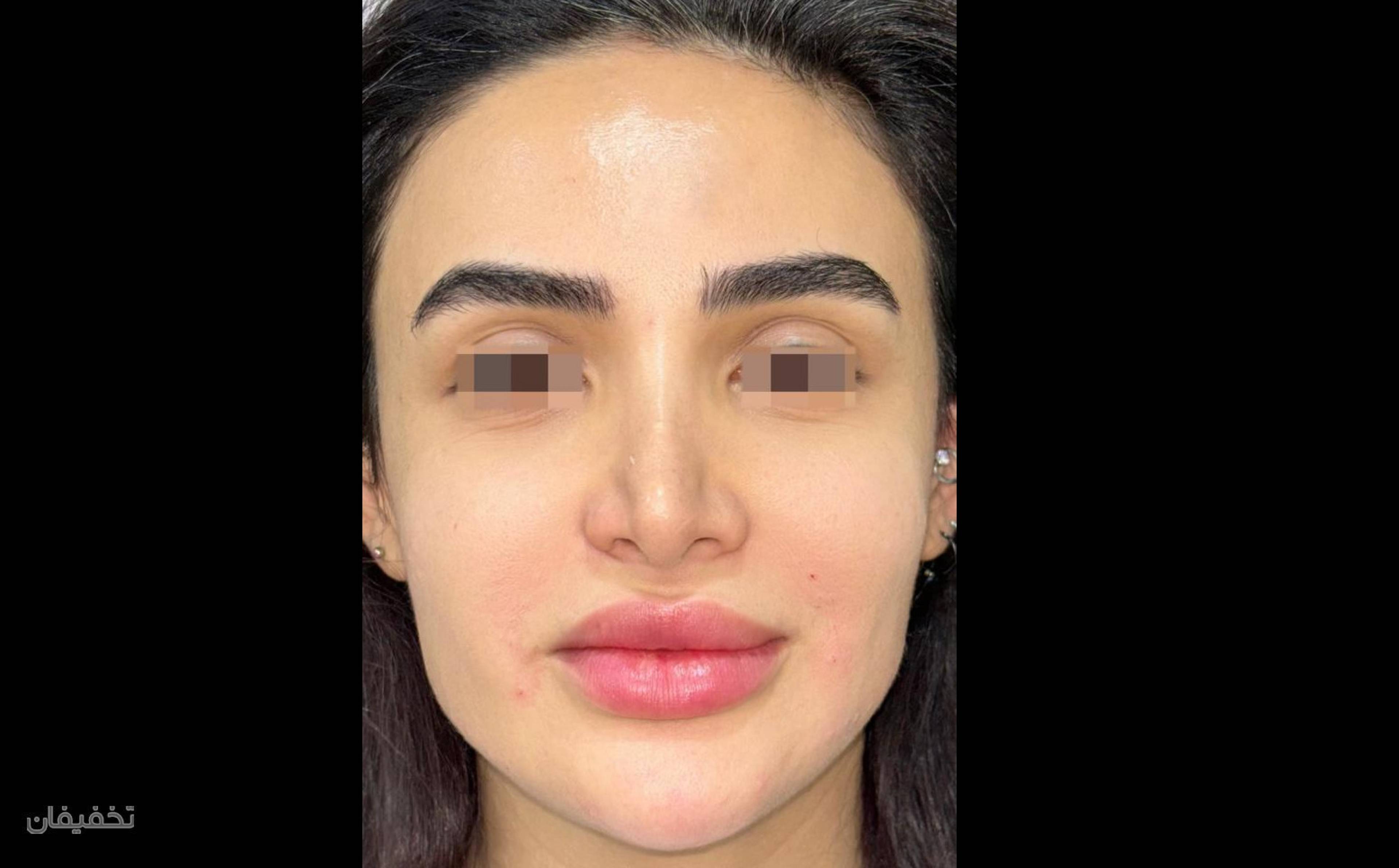 مرکز جراحی زیبایی لیلیانا
