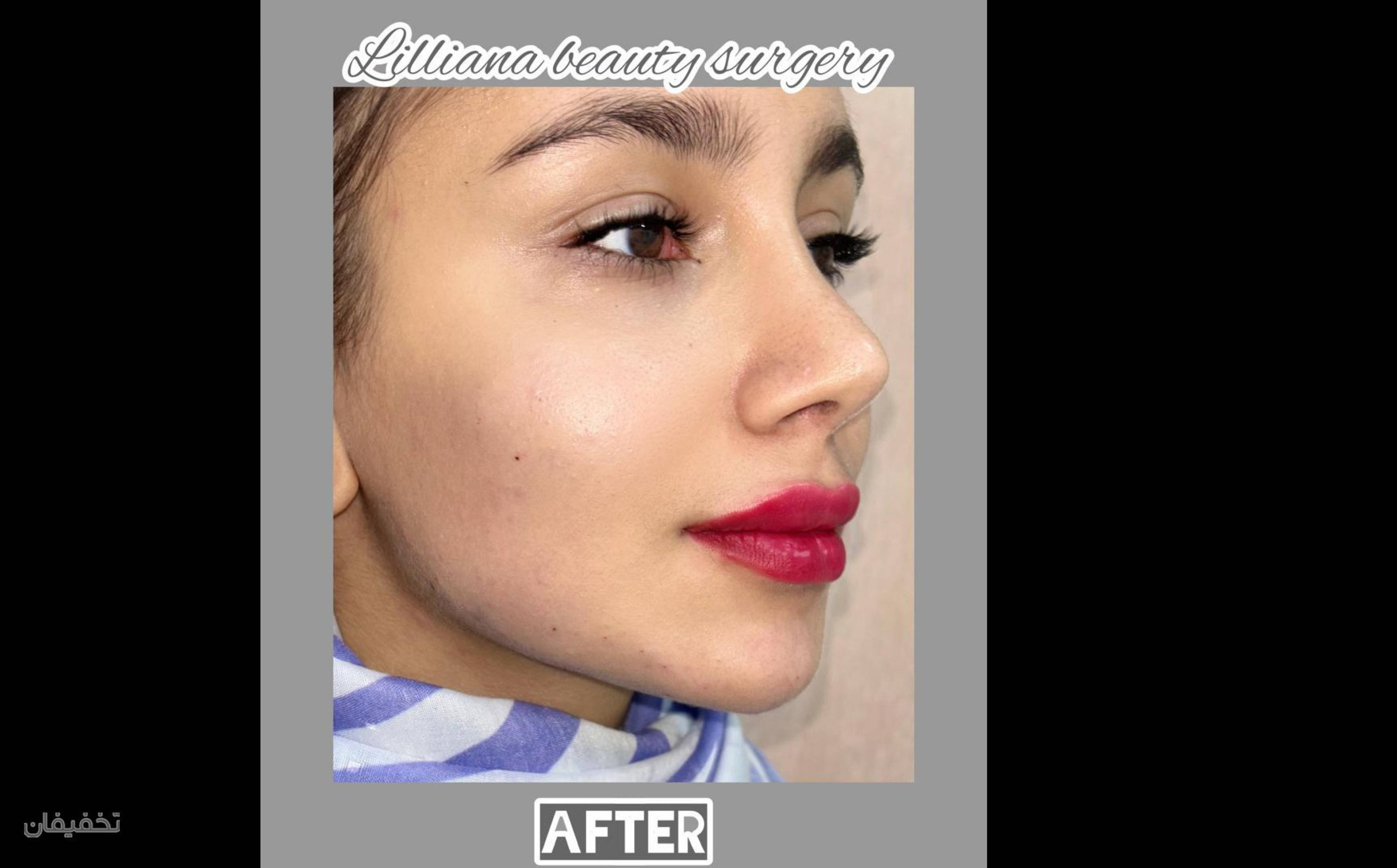 مرکز جراحی زیبایی لیلیانا