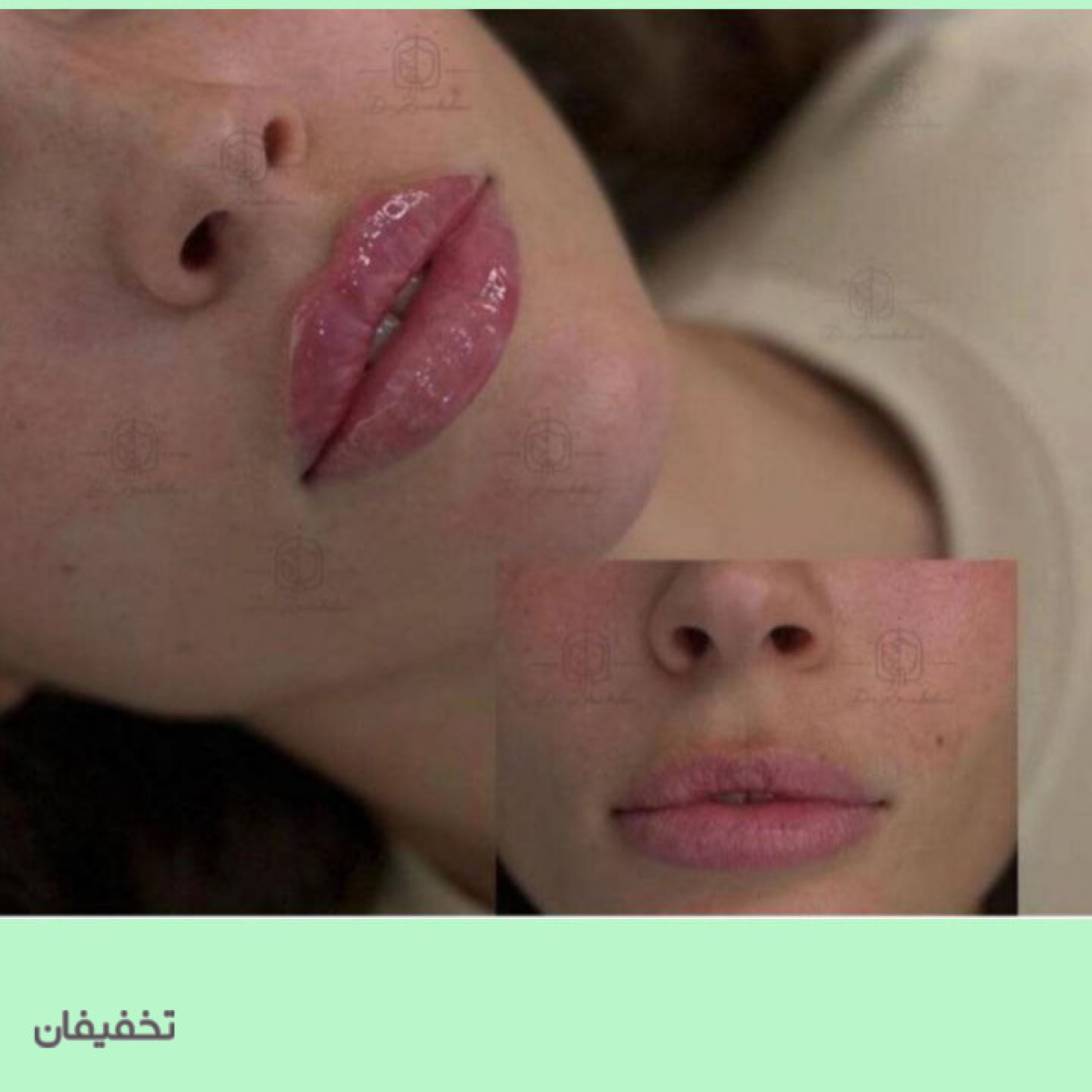 مطب پوست و زیبایی دکتر زرین بادینی