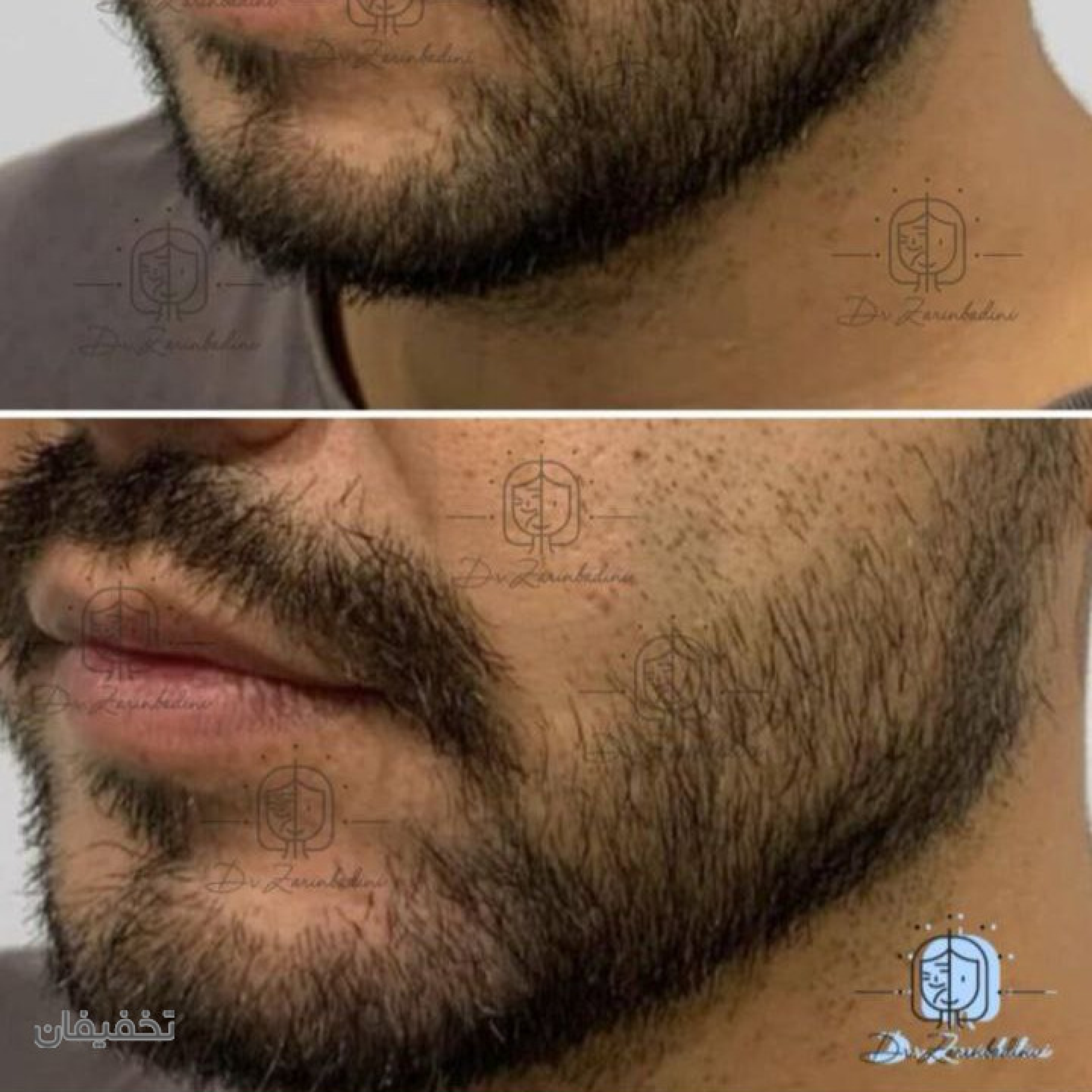 مطب پوست و زیبایی دکتر زرین بادینی