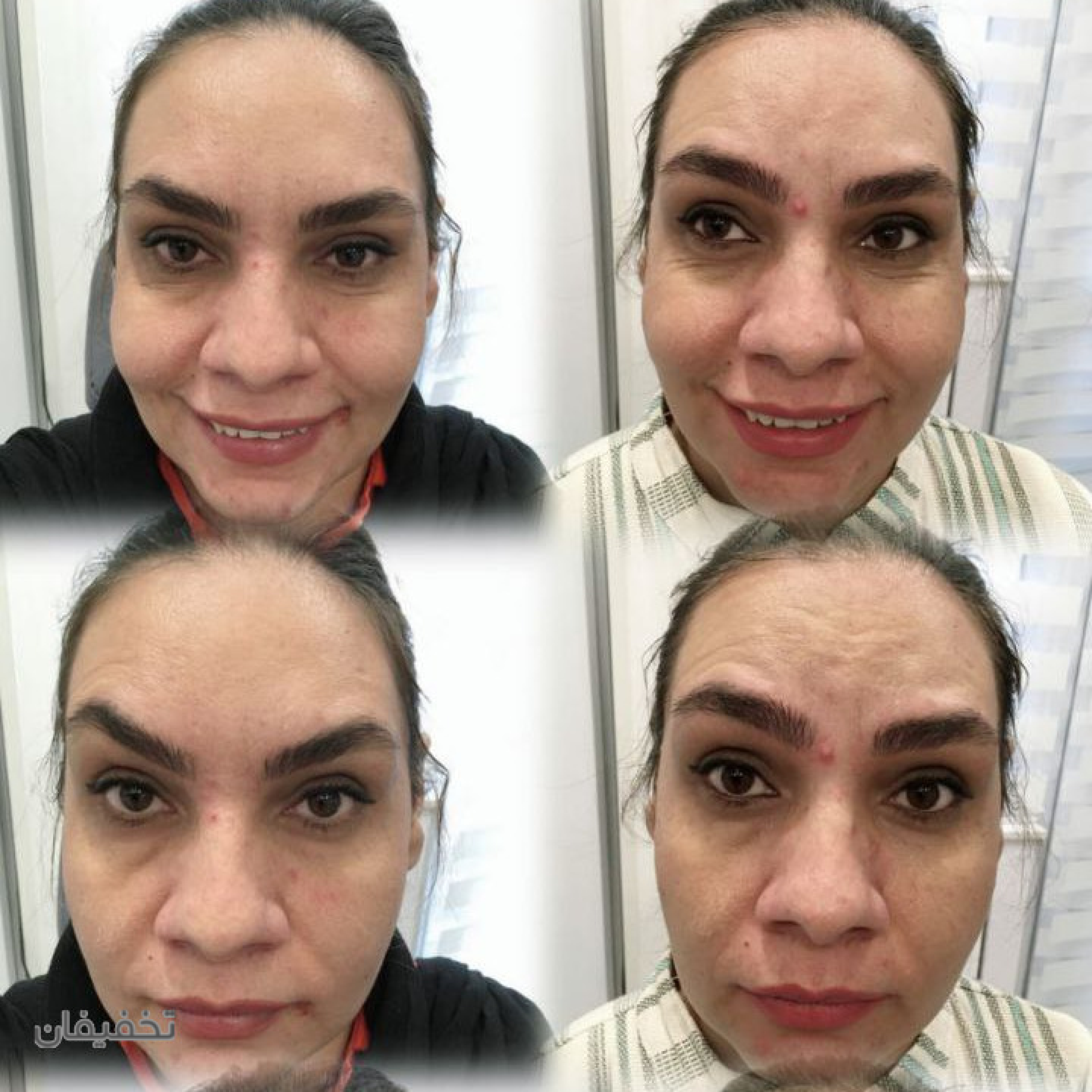 مطب پوست و زیبایی دکتر زرین بادینی
