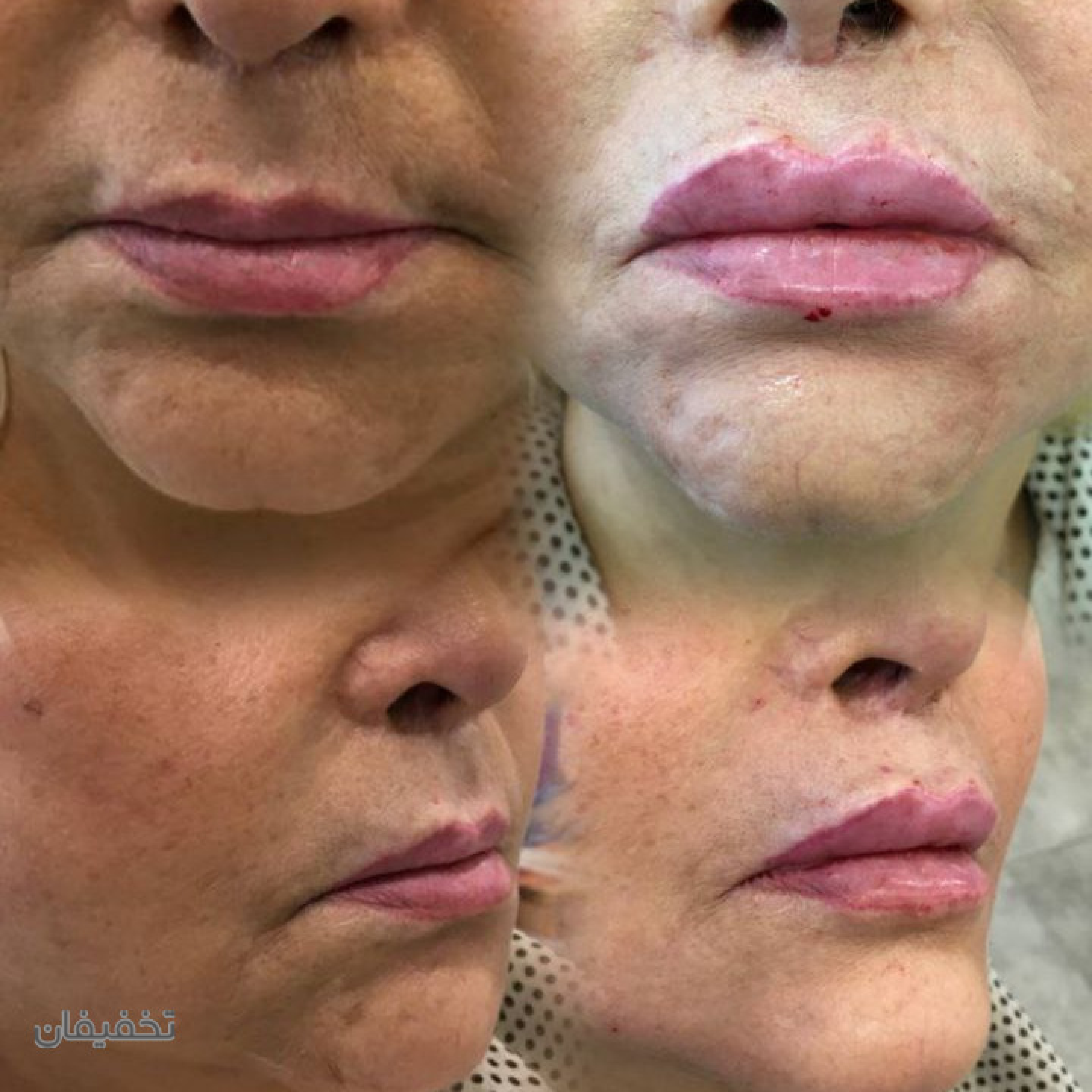 مطب پوست و زیبایی دکتر زرین بادینی