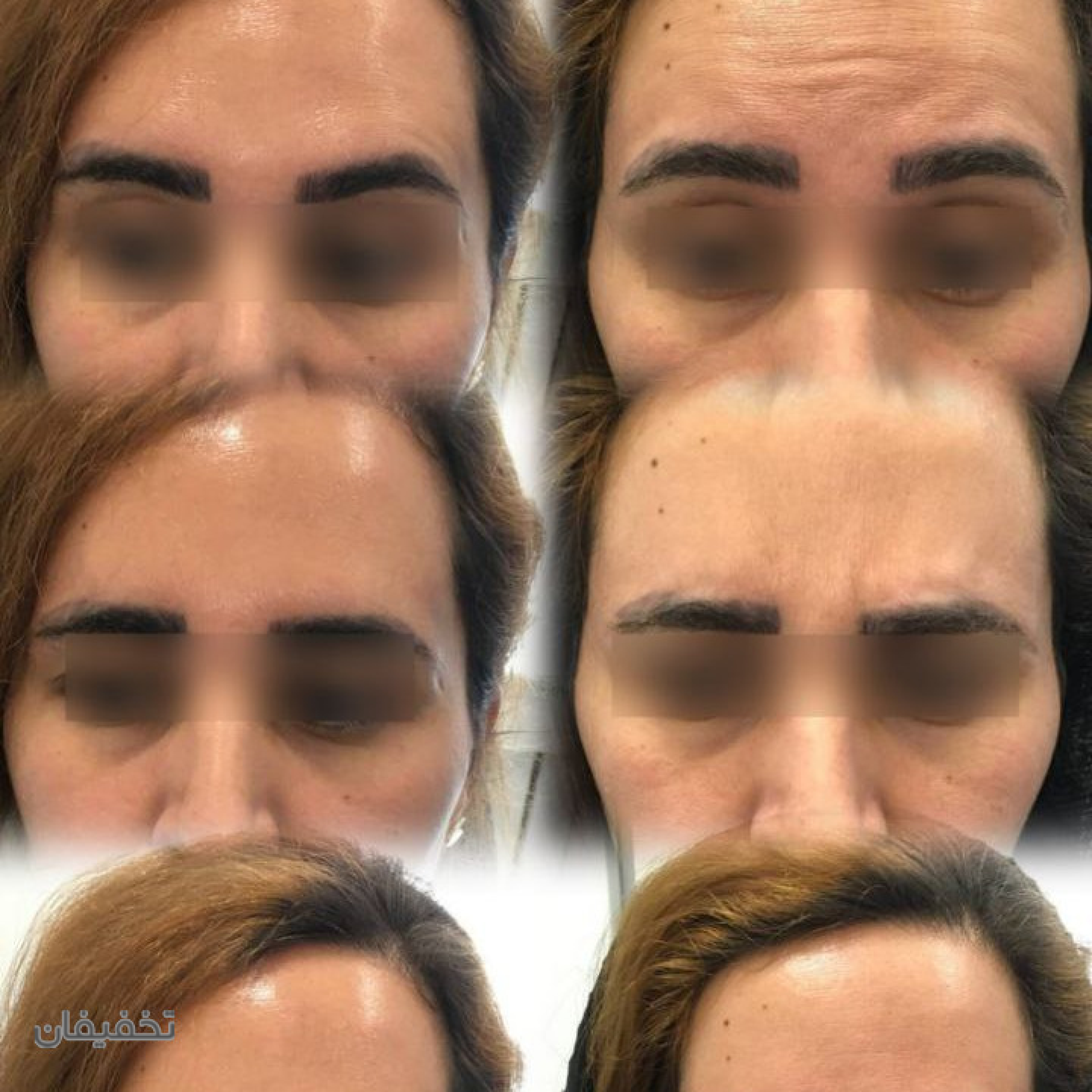 مطب پوست و زیبایی دکتر زرین بادینی