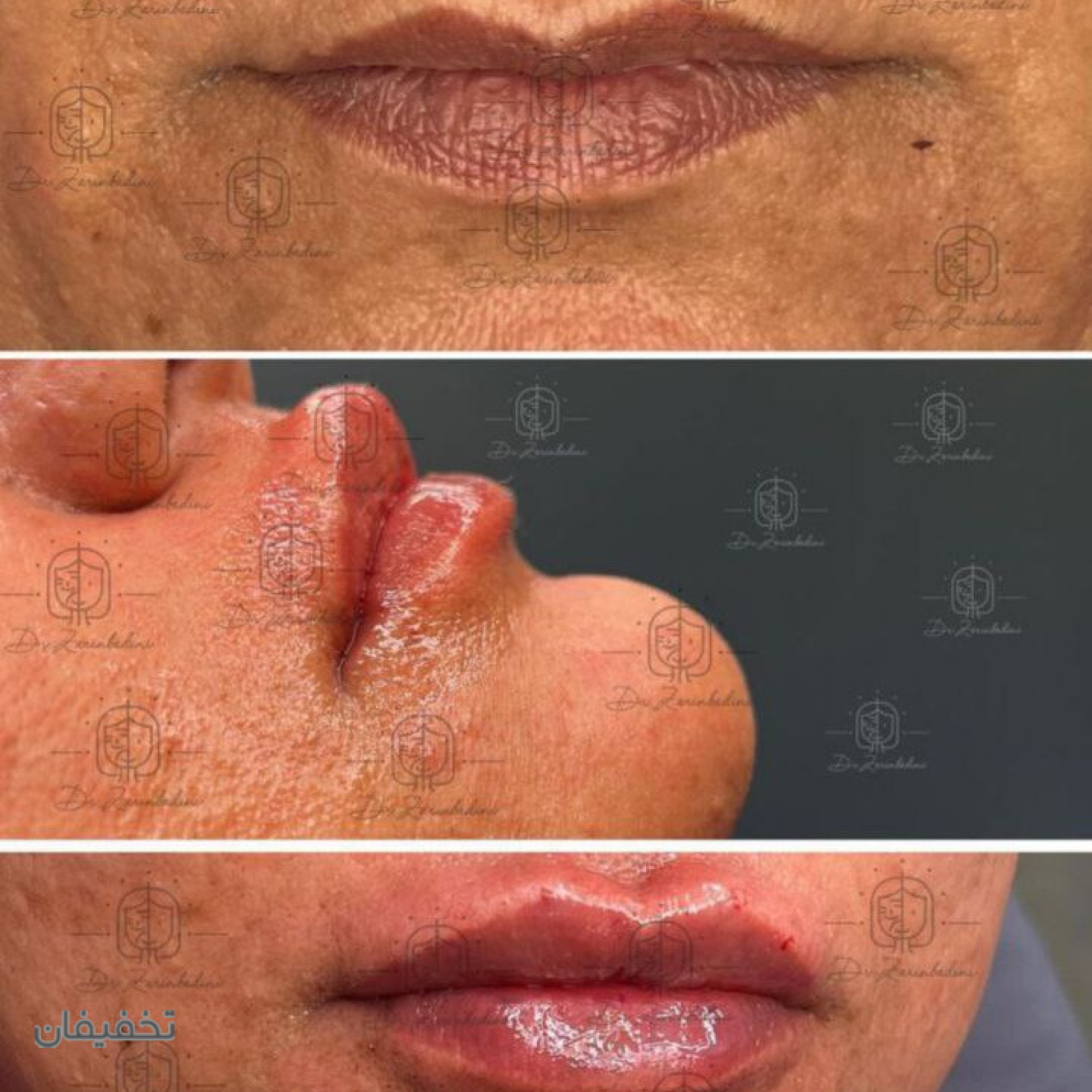 مطب پوست و زیبایی دکتر زرین بادینی