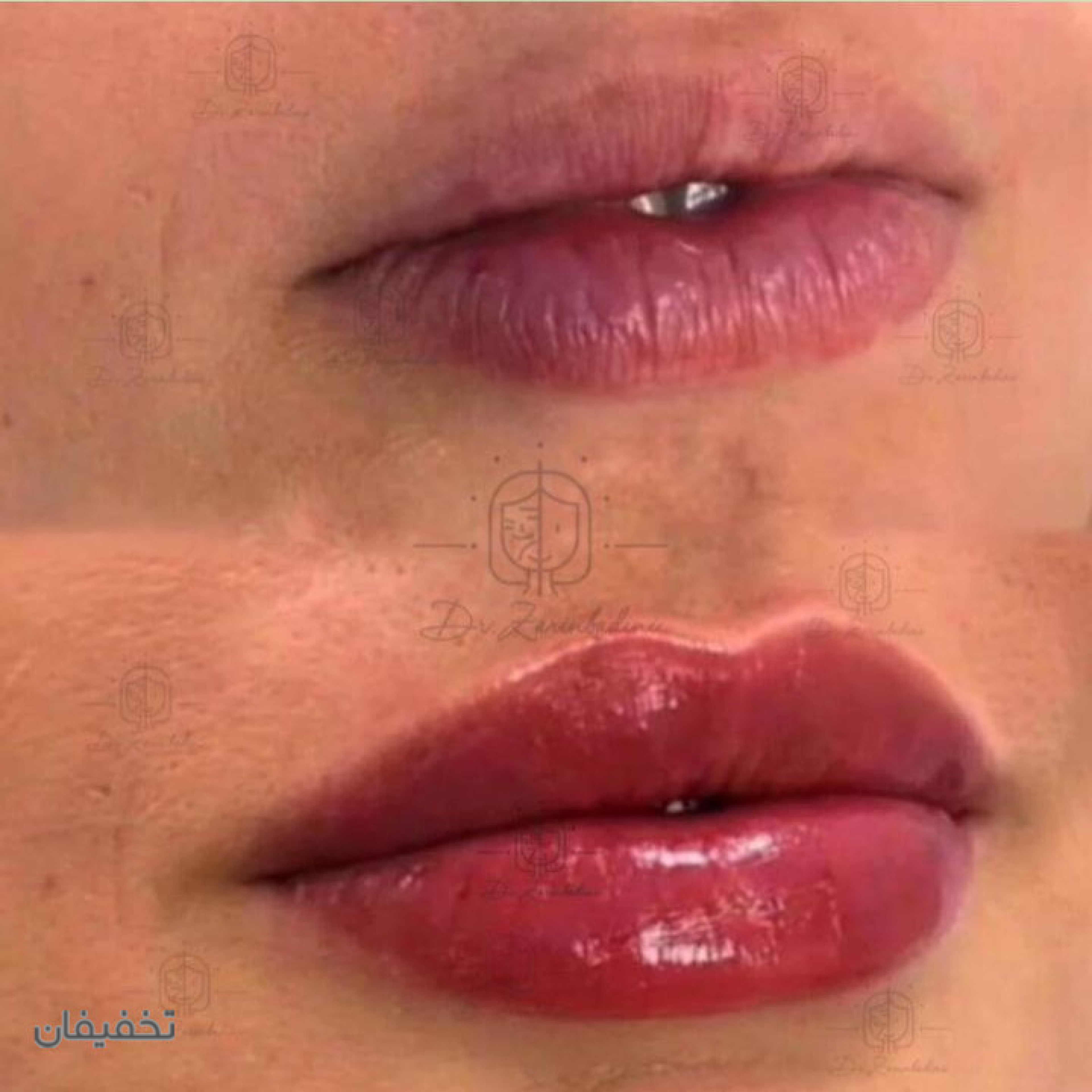 مطب پوست و زیبایی دکتر زرین بادینی