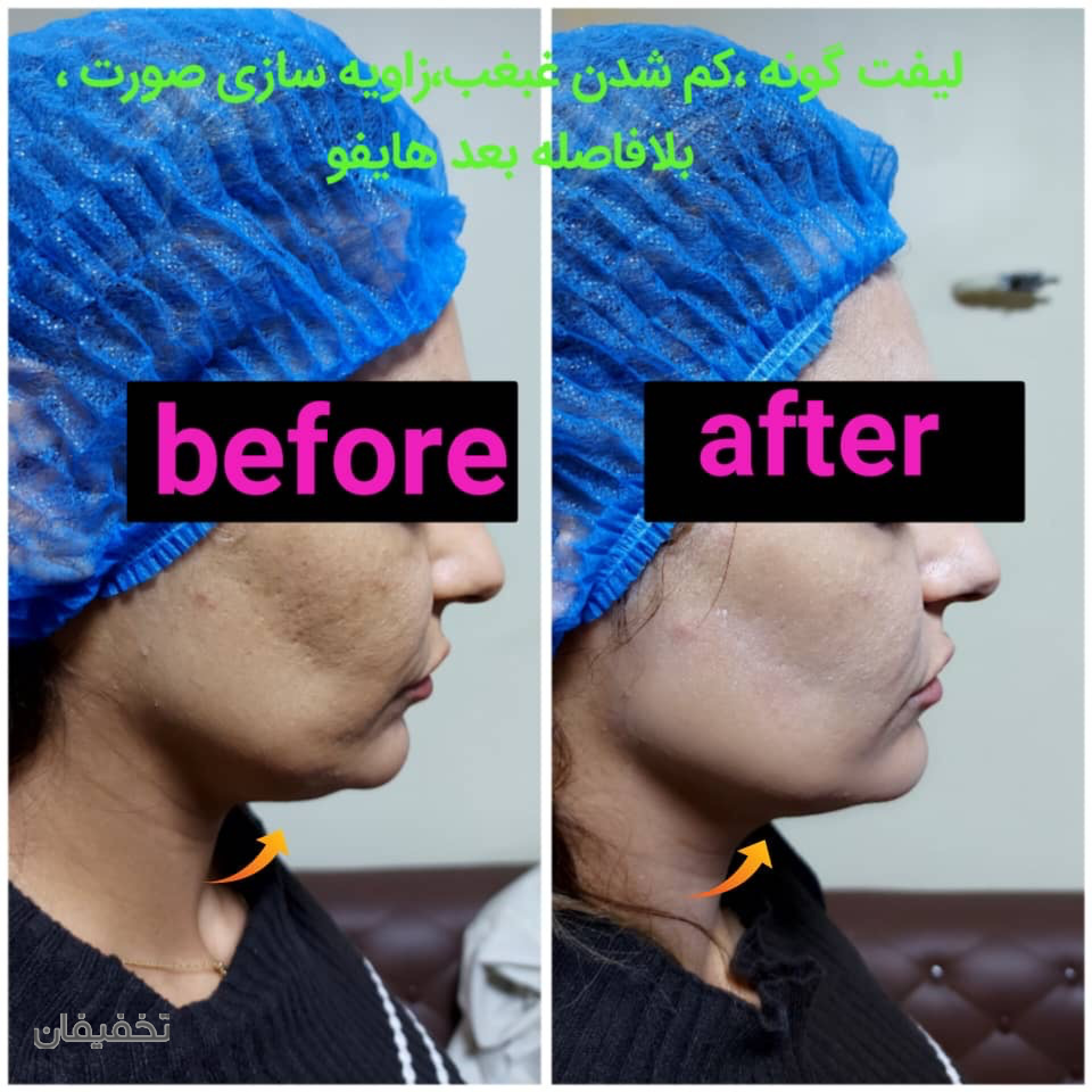 كلينيك زيبايي مهشيد ذاكري