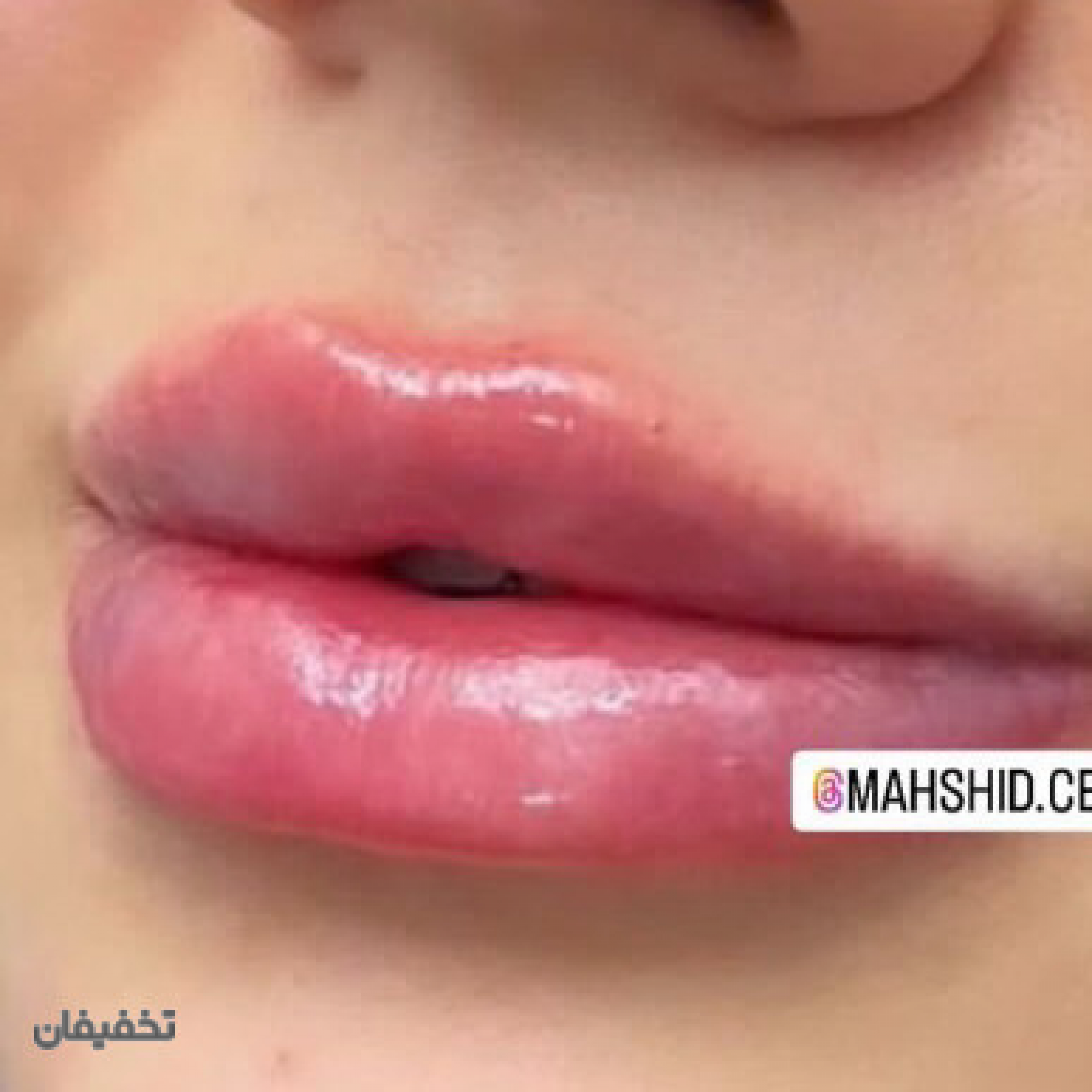 كلينيك زيبايي مهشيد ذاكري