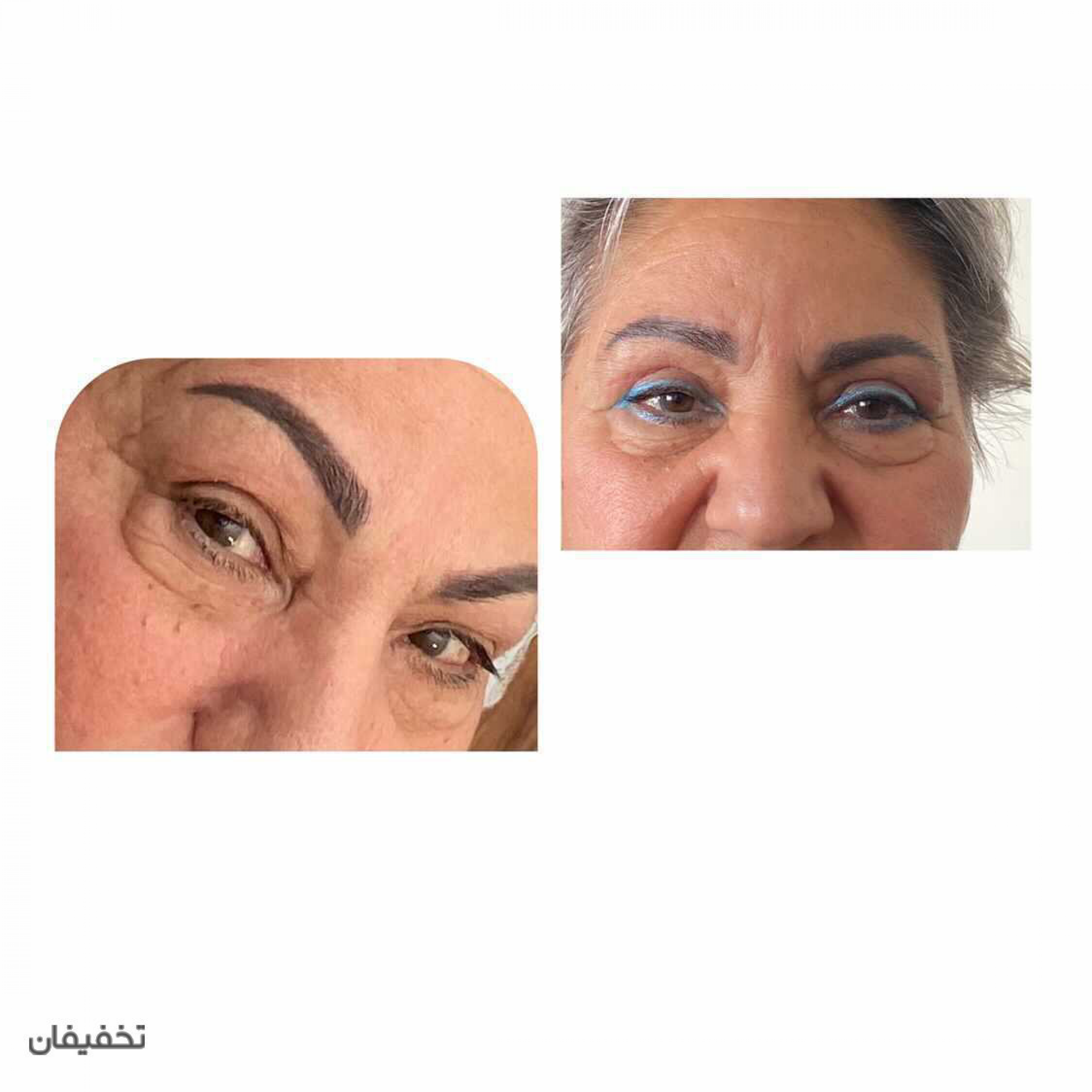 كلينيك زيبايي مهشيد ذاكري
