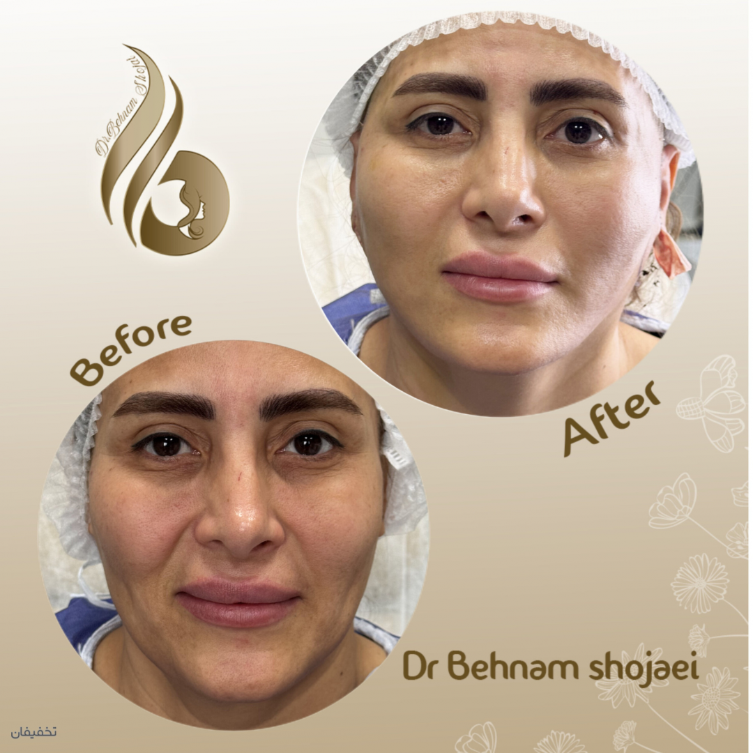 کلینیک زیبایی دکتر بهنام شجاعی