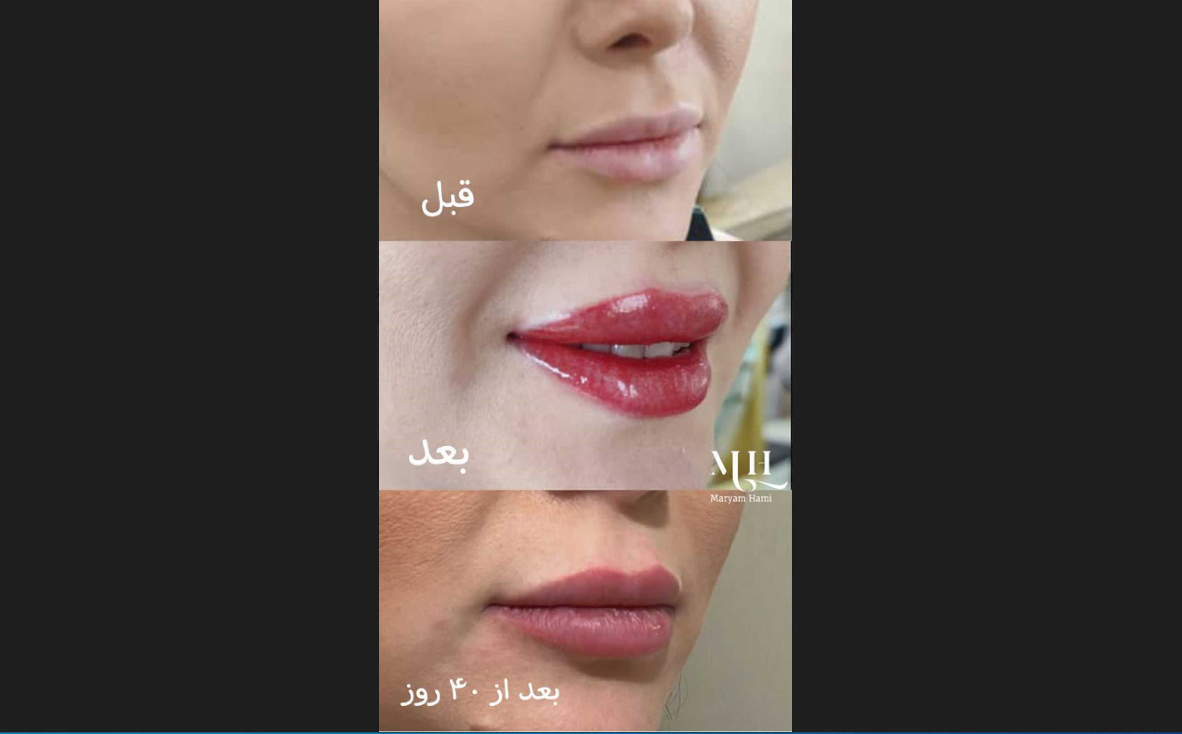 مریم حامی