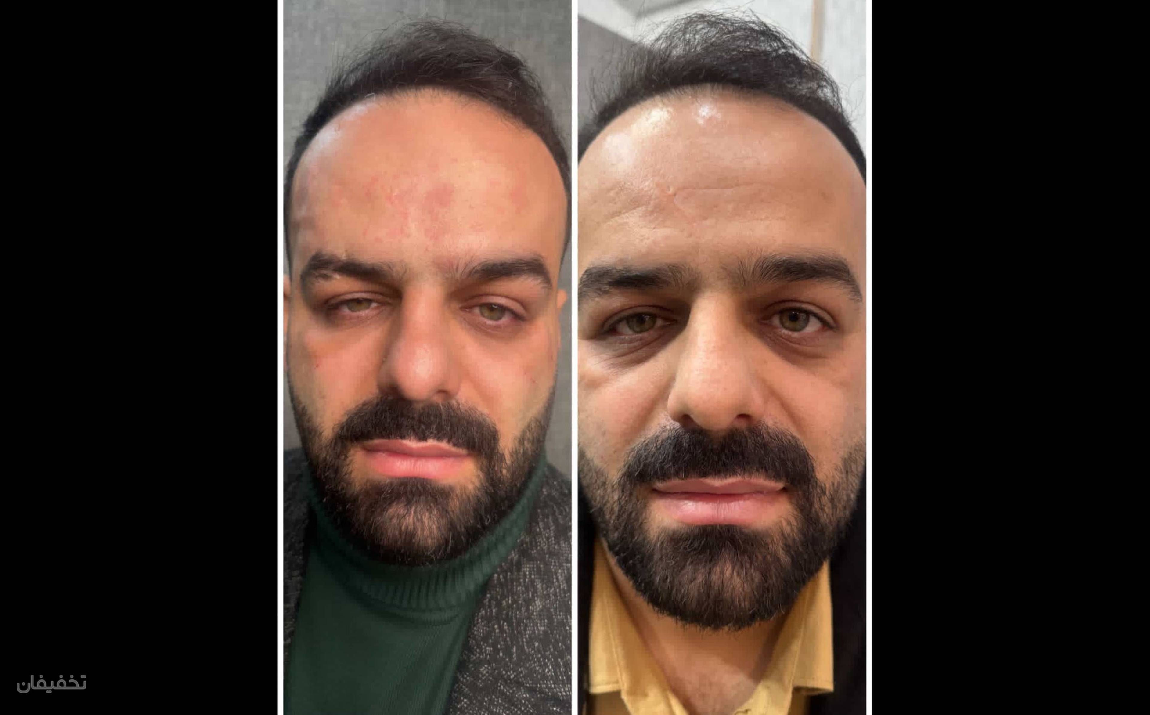 کلینیک زیبایی اریکا
