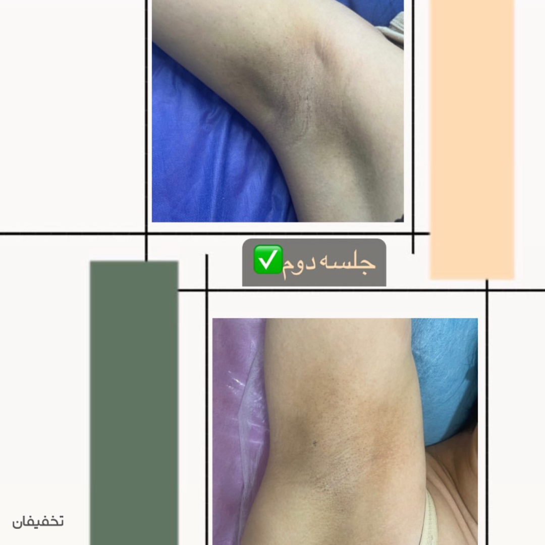 دکتر لیزر