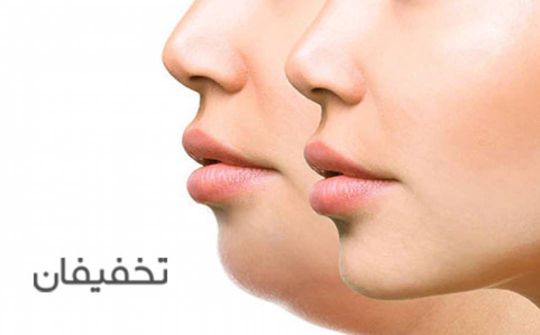 مطب دکتر مهرابی شریعتی