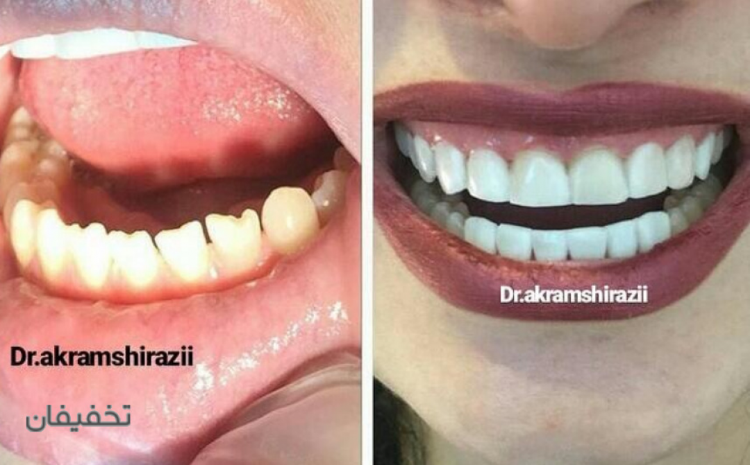 مرکز دندانپزشکی تخصصی دکتر اکرم شیرازی