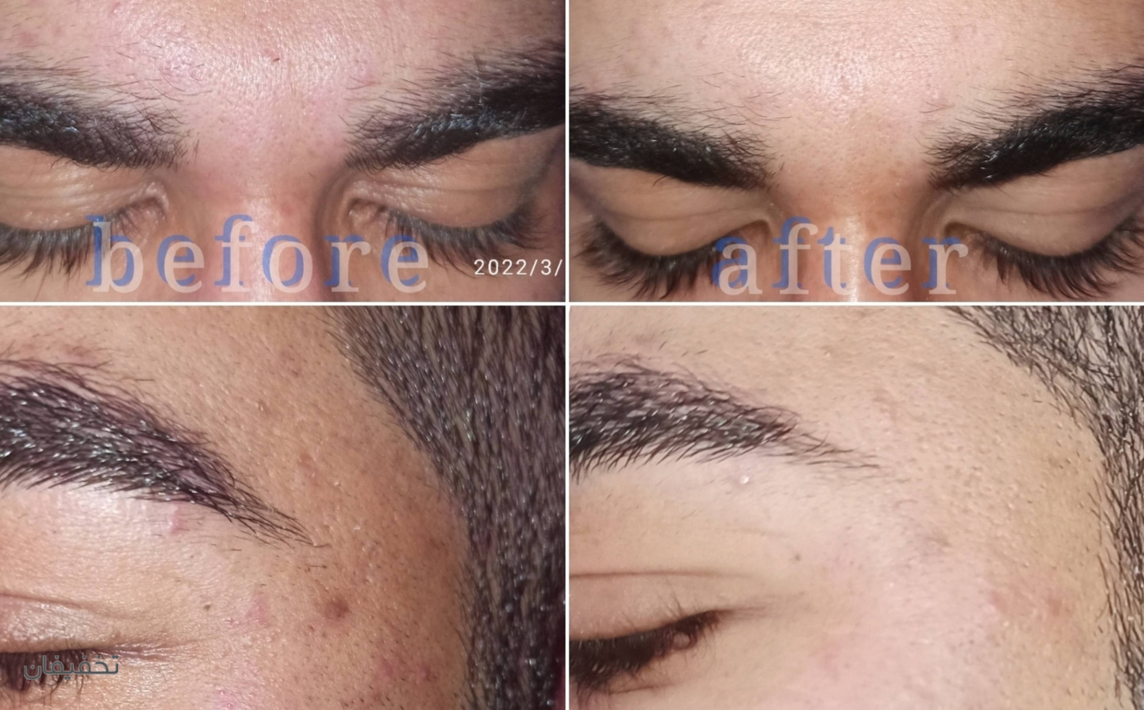 مرکز پوست سارینا