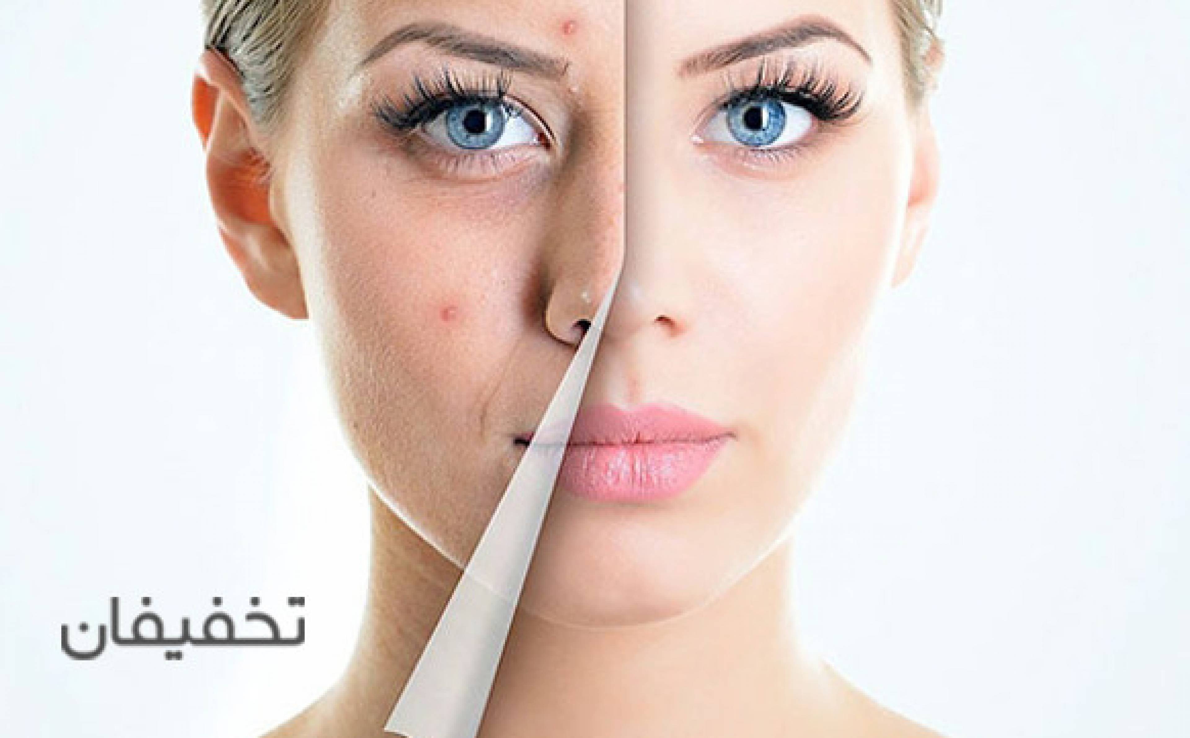 مرکز پوست هور