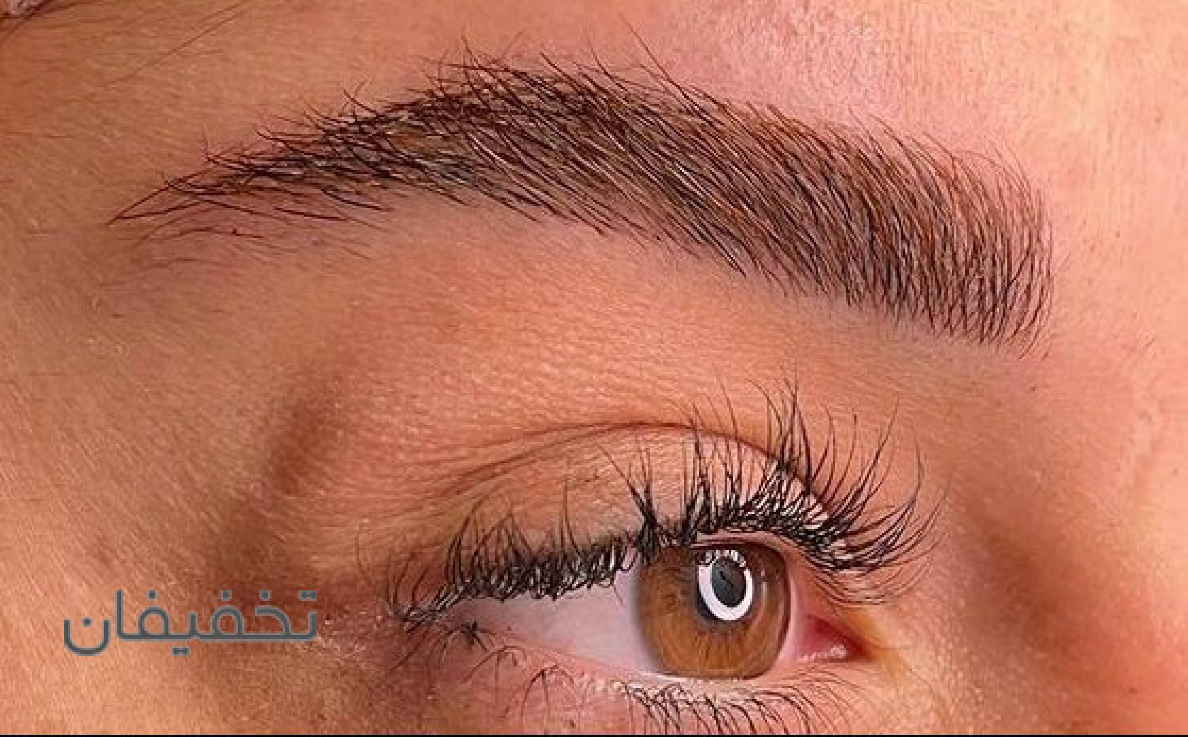 فیبروز و میکروبلیدینگ مهشید