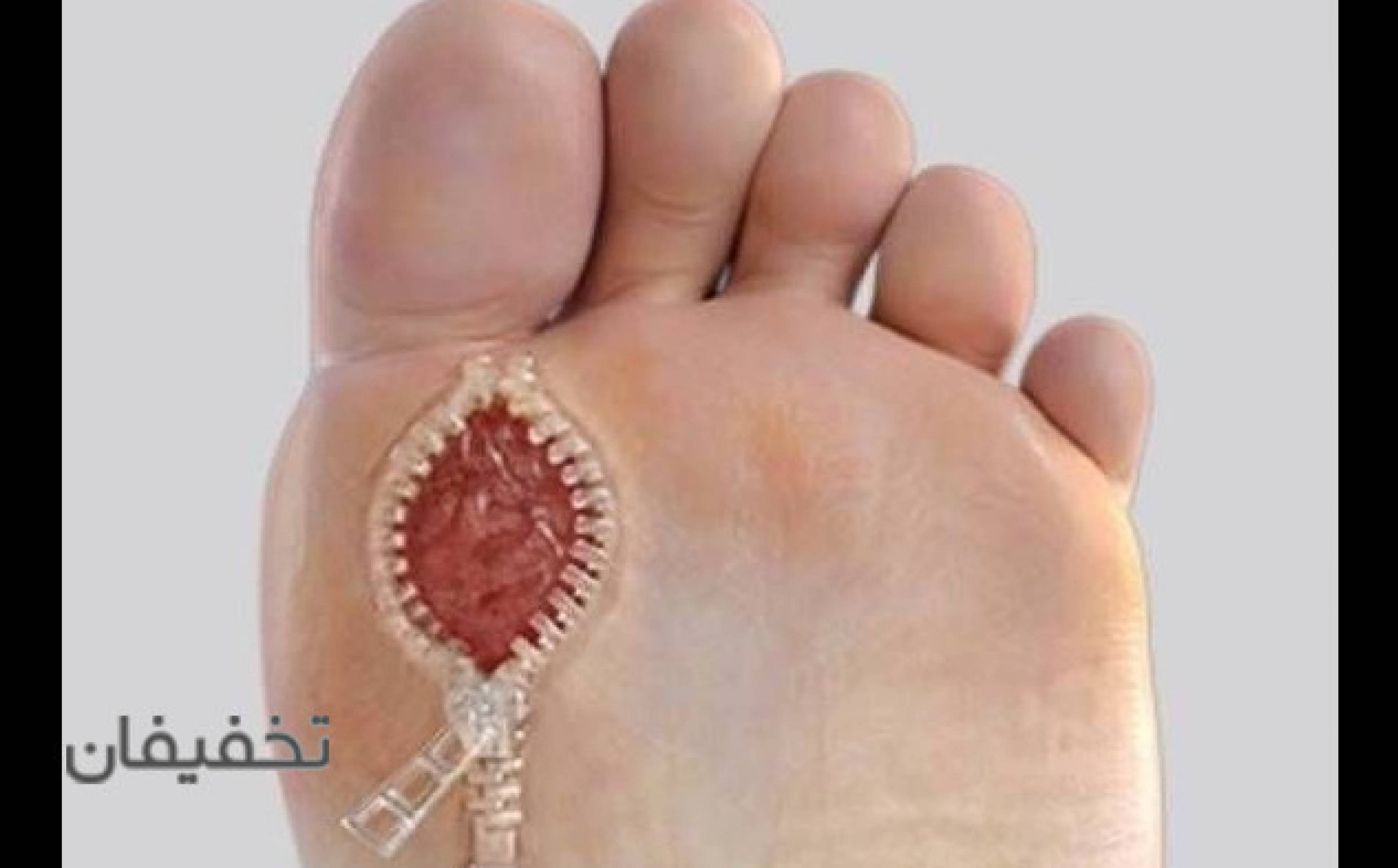 میترا غفارپور درمانگر تخصصی انواع زخم