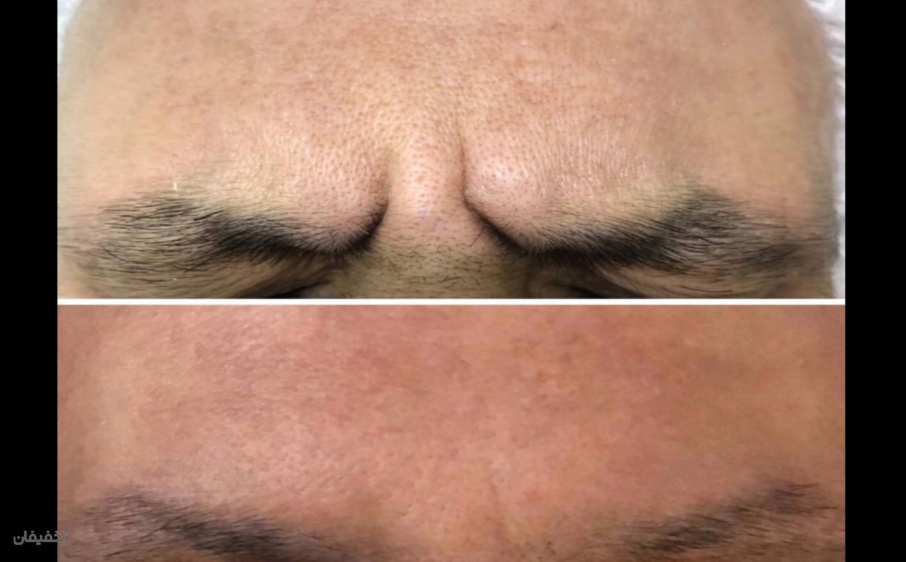 مطب لاغری و زیبایی ماه تهران