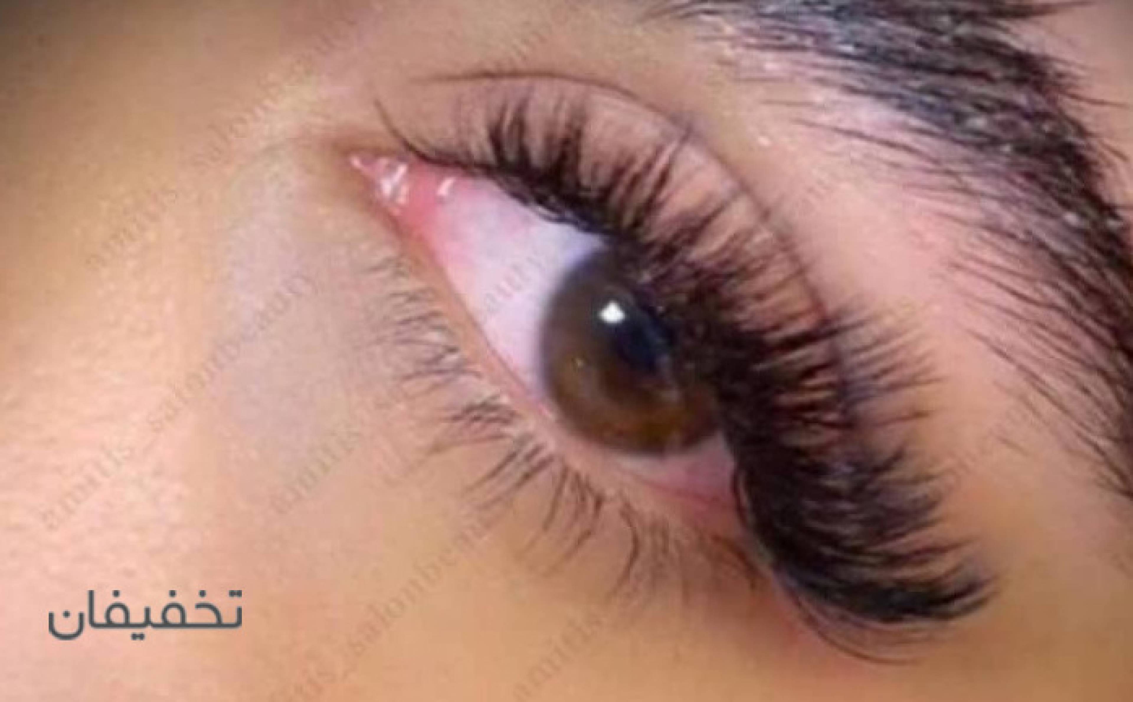سالن امیتیس
