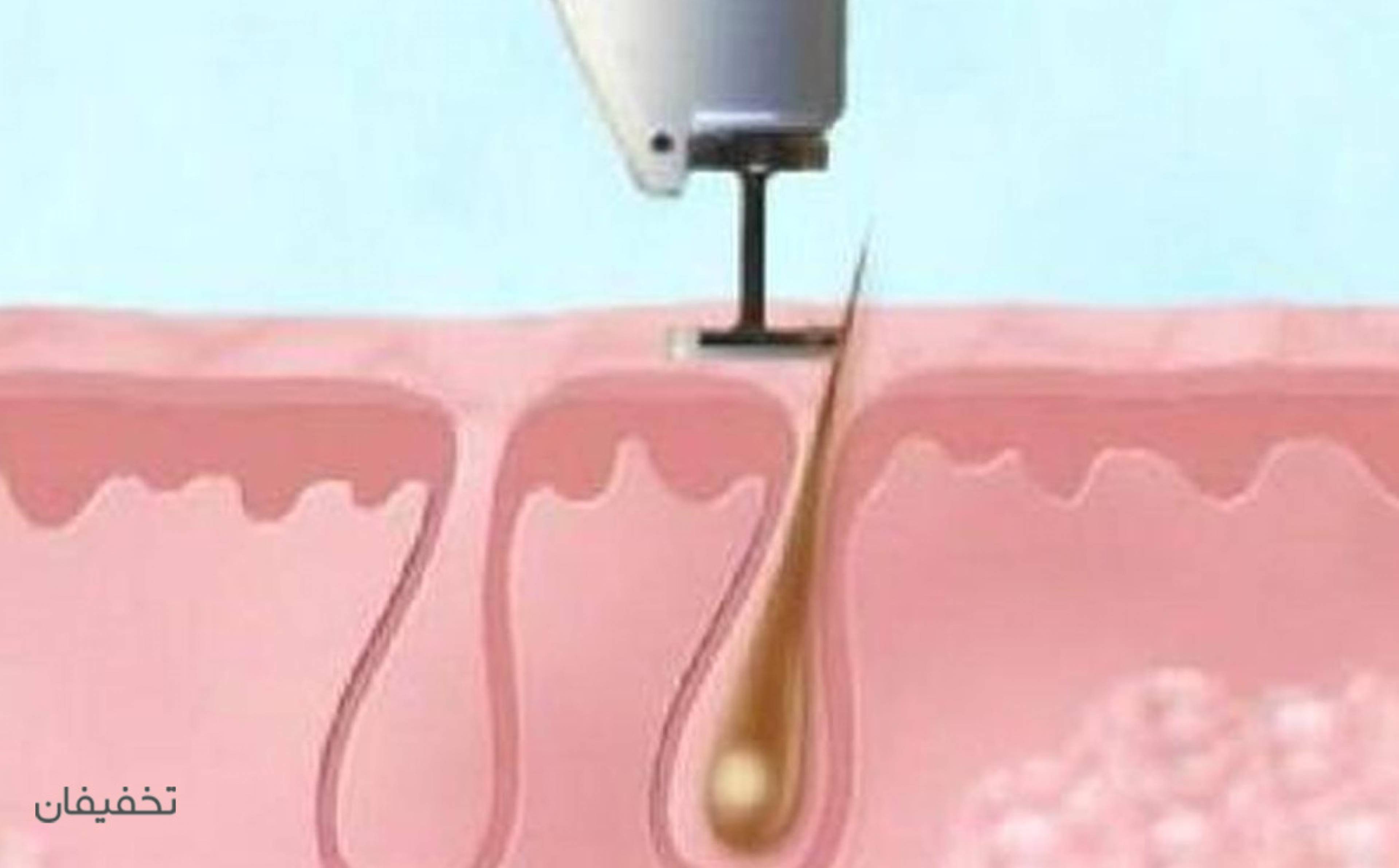 مطب دکتر حنانه عظیمی