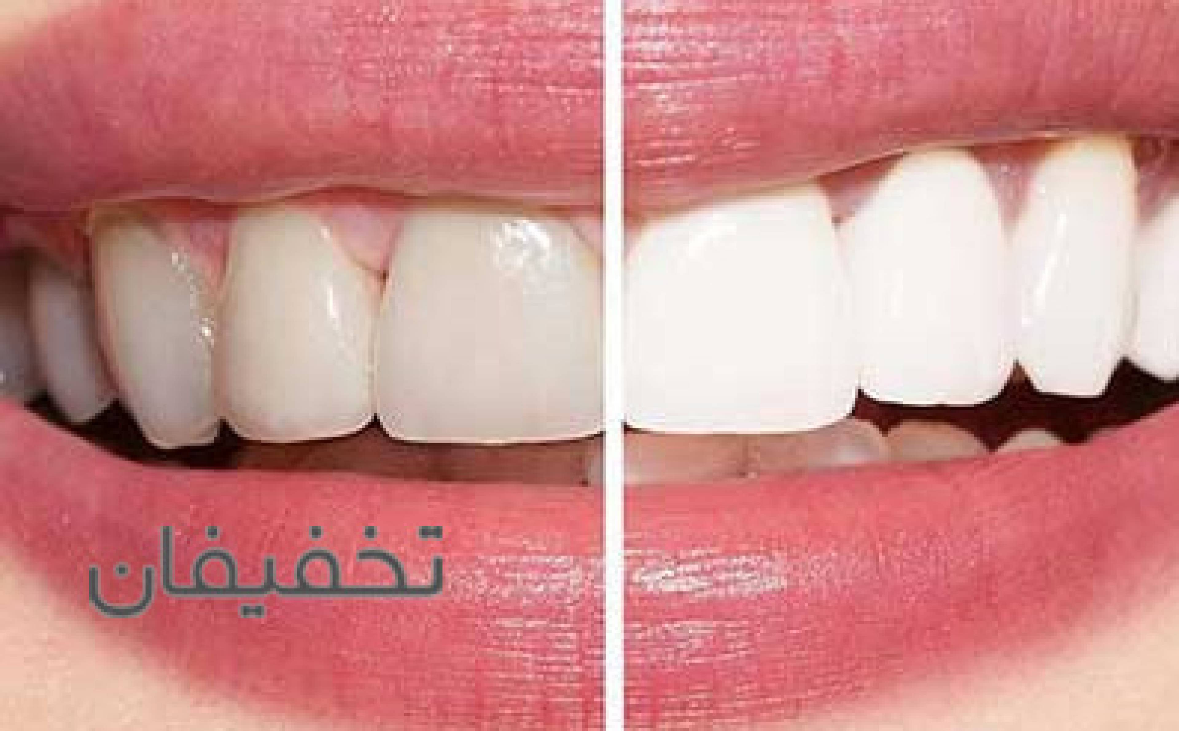 مرکز دندانپزشکی کارن