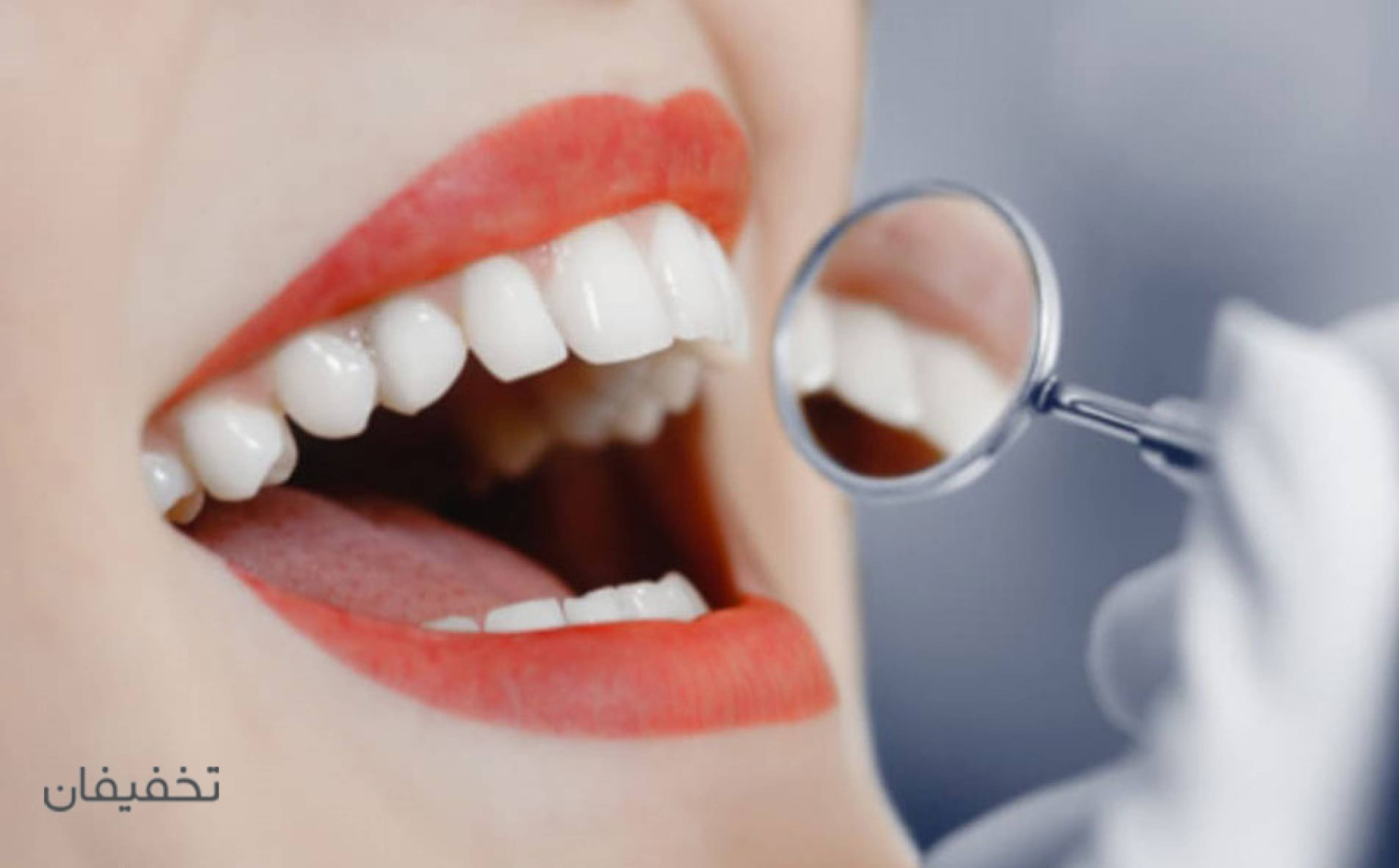 مرکز دندانپزشکی الیز