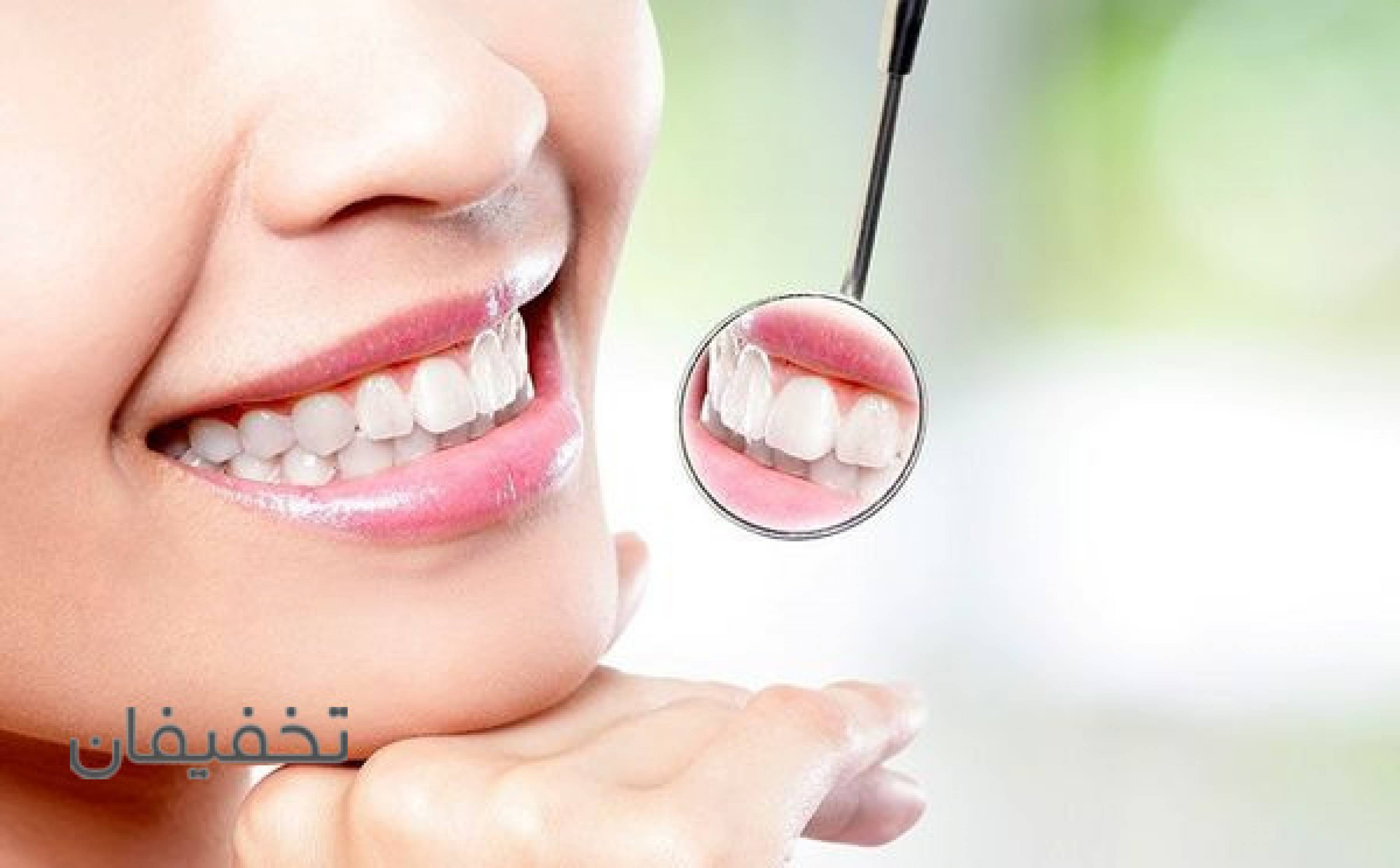 مرکز دندانپزشکی الیز