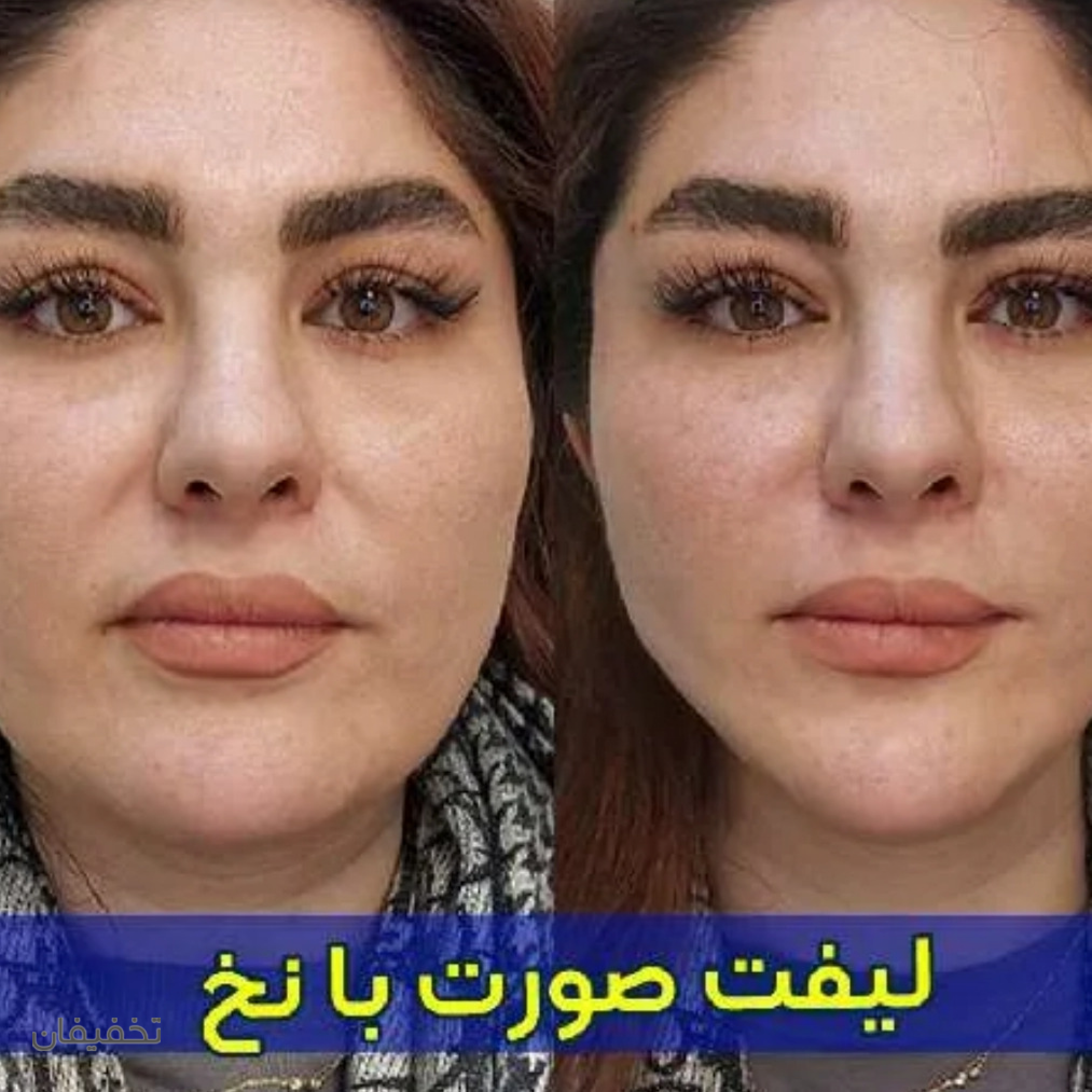 مرکز پوست مو زیبایی اِلسا