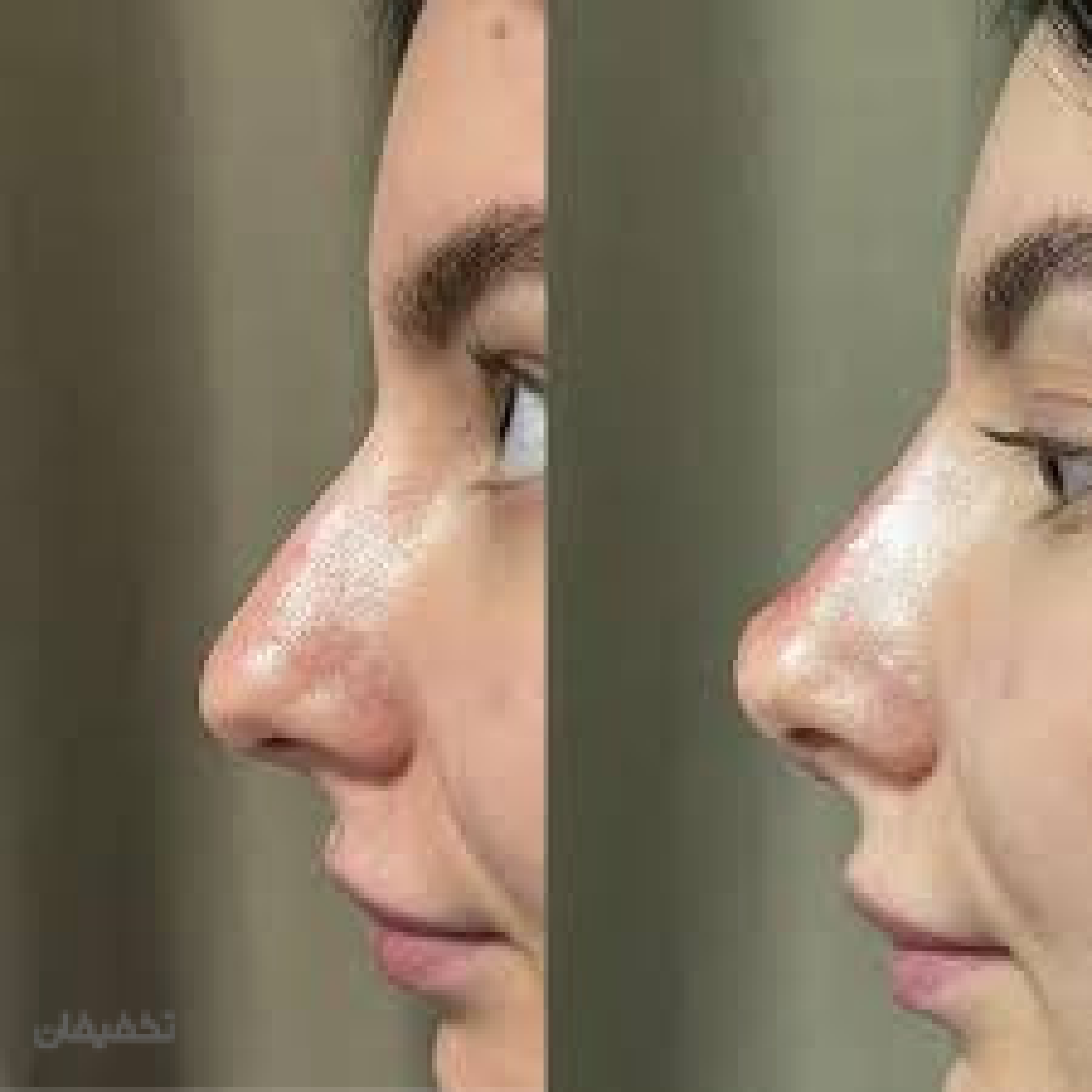 مرکز پوست مو زیبایی اِلسا