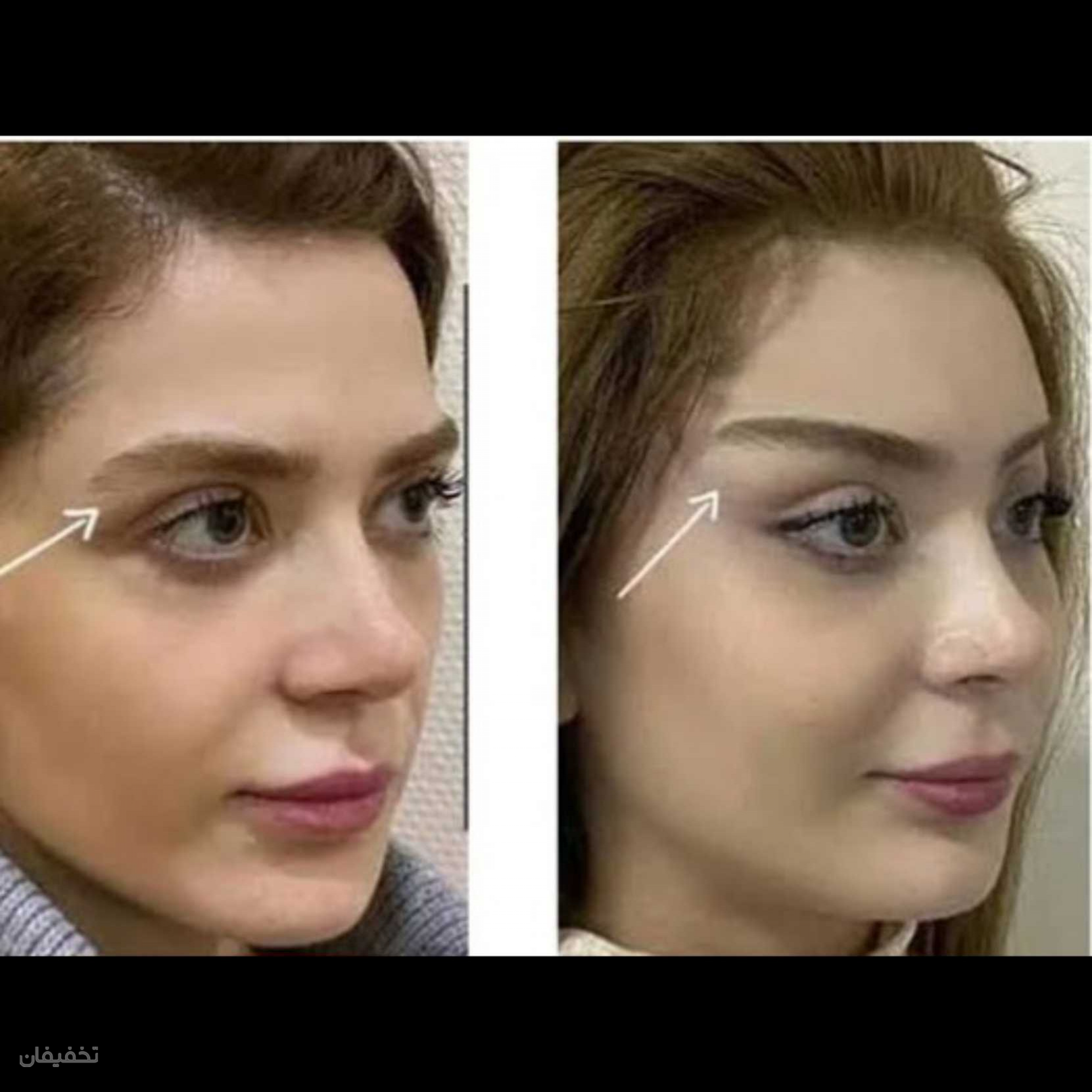 مرکز پوست مو زیبایی اِلسا