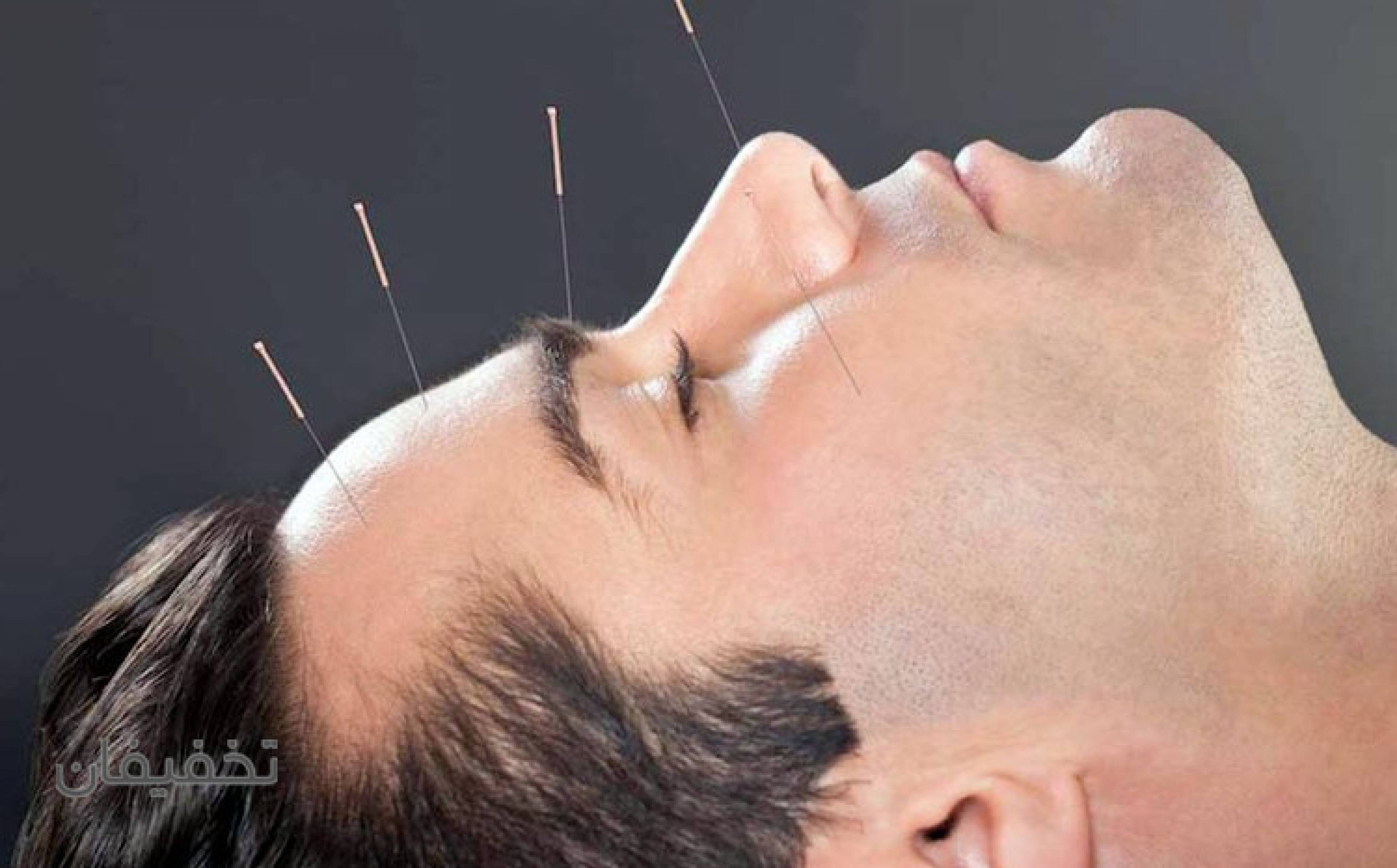 مطب طب سوزنی دکتر وحید قاسمی(شعبه فرمانیه)