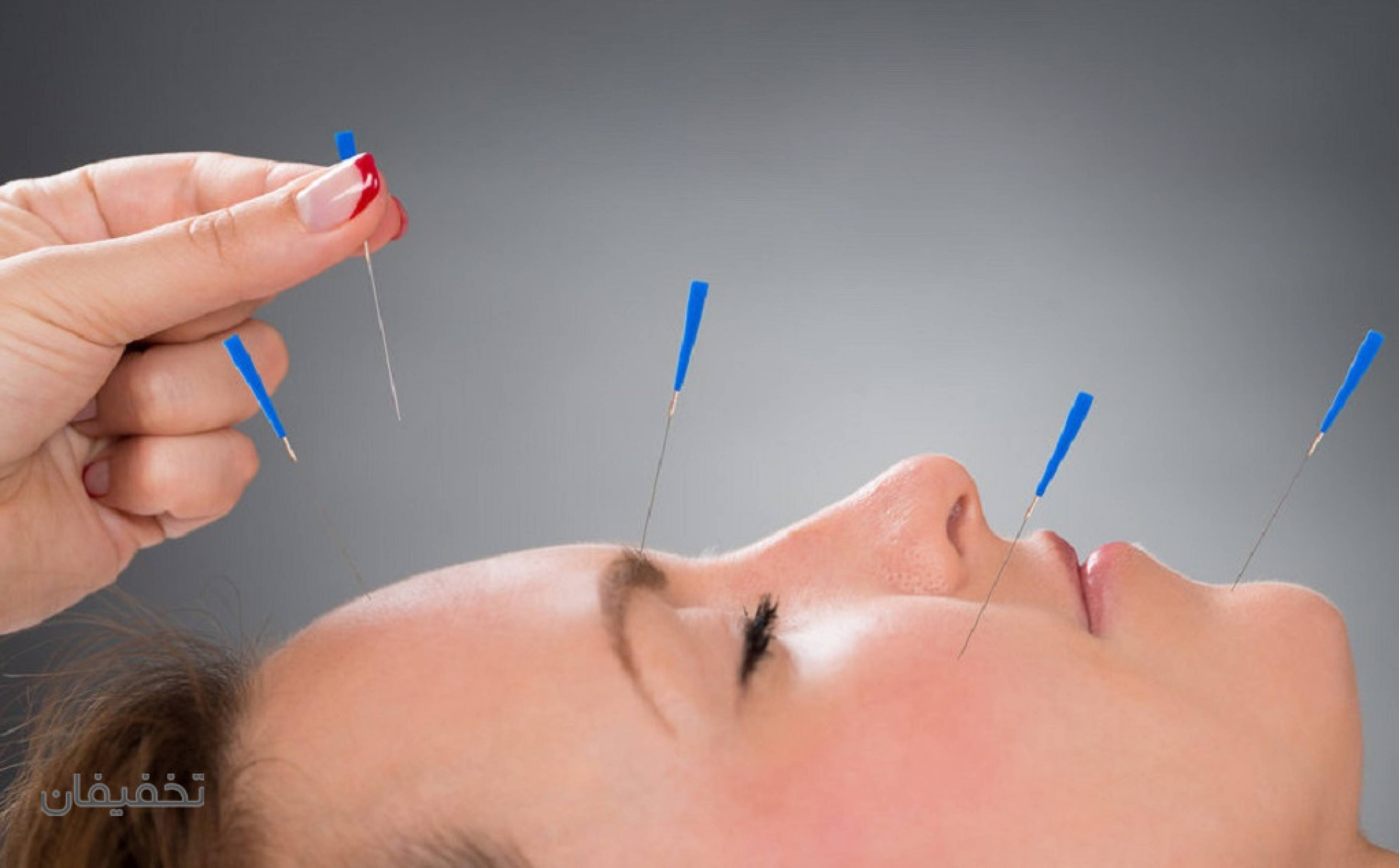 مطب طب سوزنی دکتر وحید قاسمی(شعبه فرمانیه)