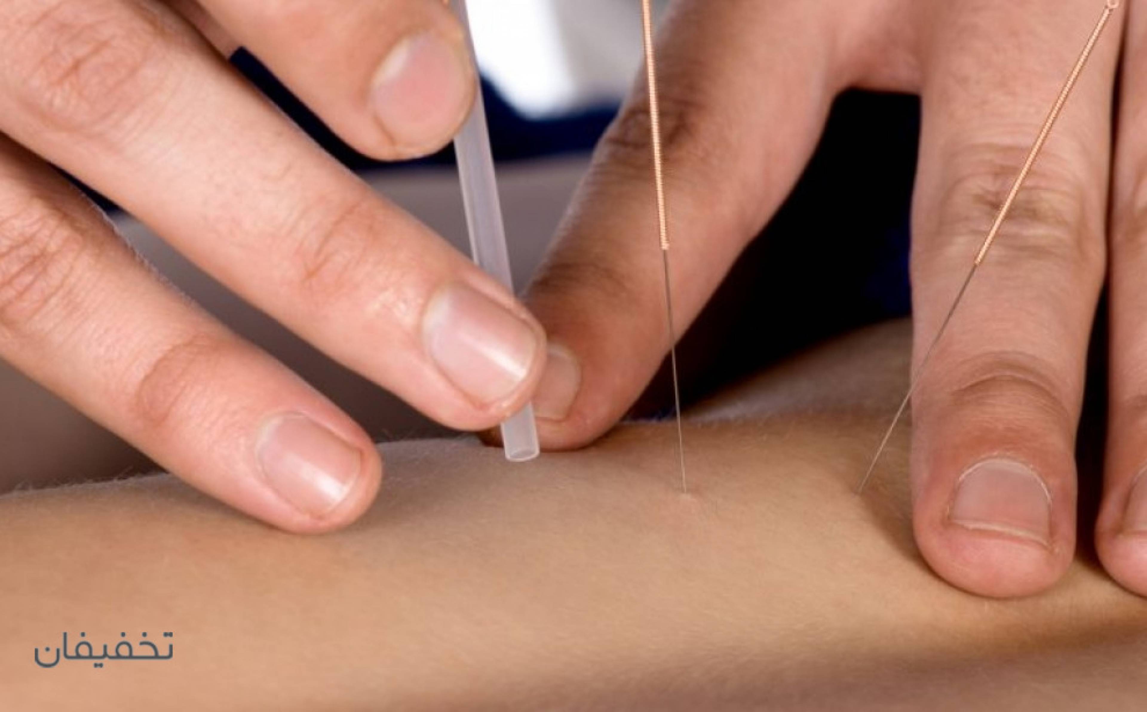 مطب طب سوزنی دکتر وحید قاسمی(شعبه فرمانیه)