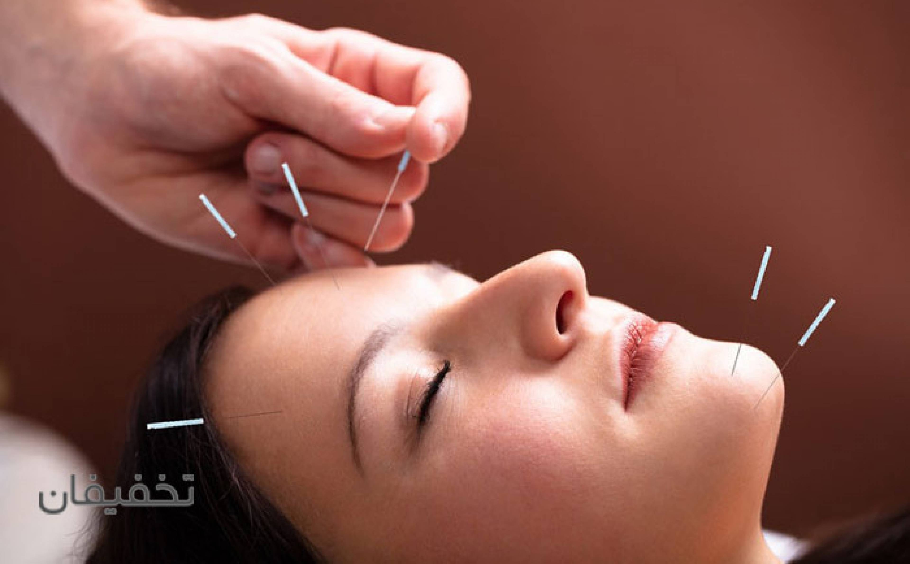 مطب طب سوزنی دکتر وحید قاسمی(شعبه فرمانیه)