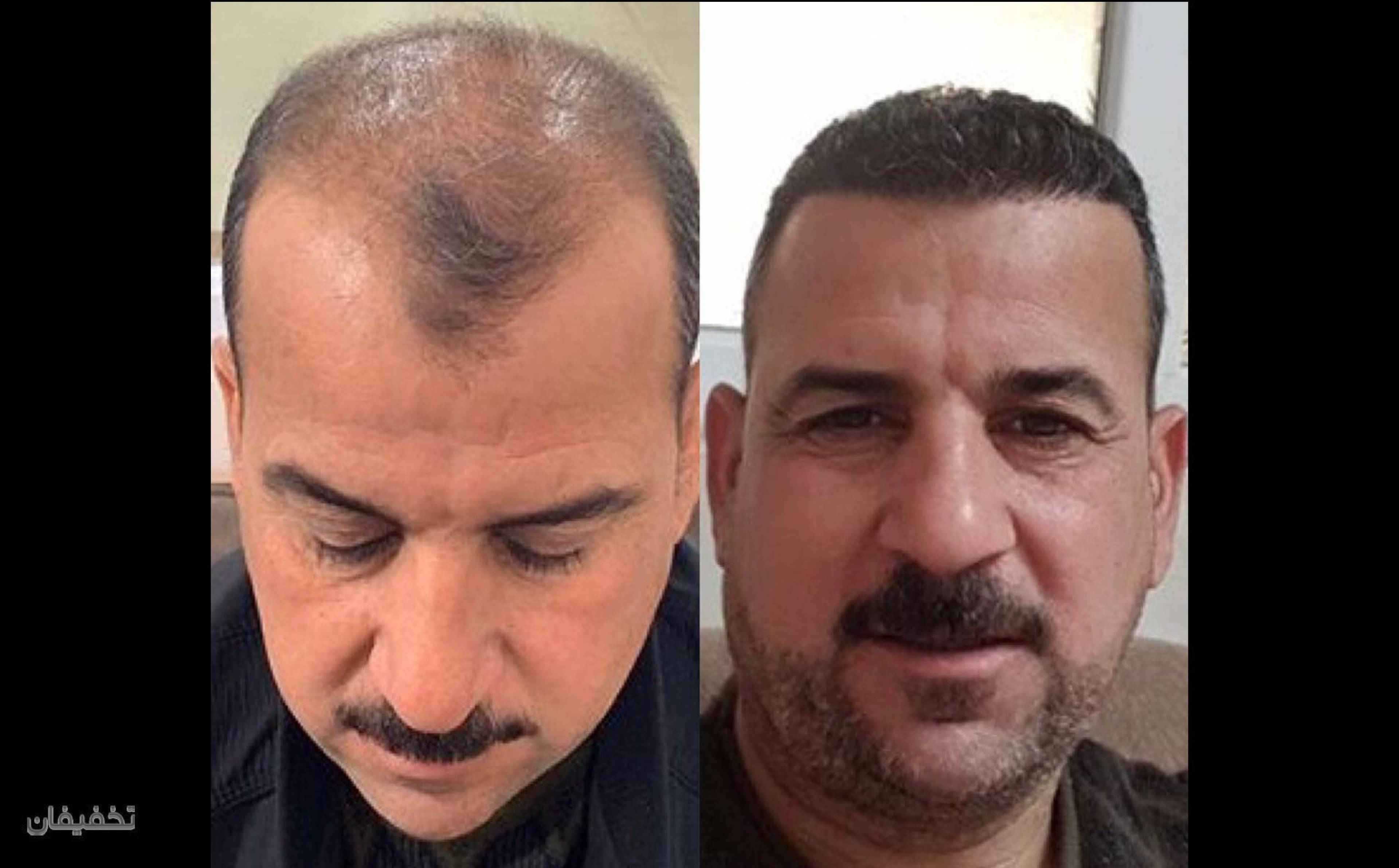 مرکز تخصصی پوست و لیزر دکتر امینی