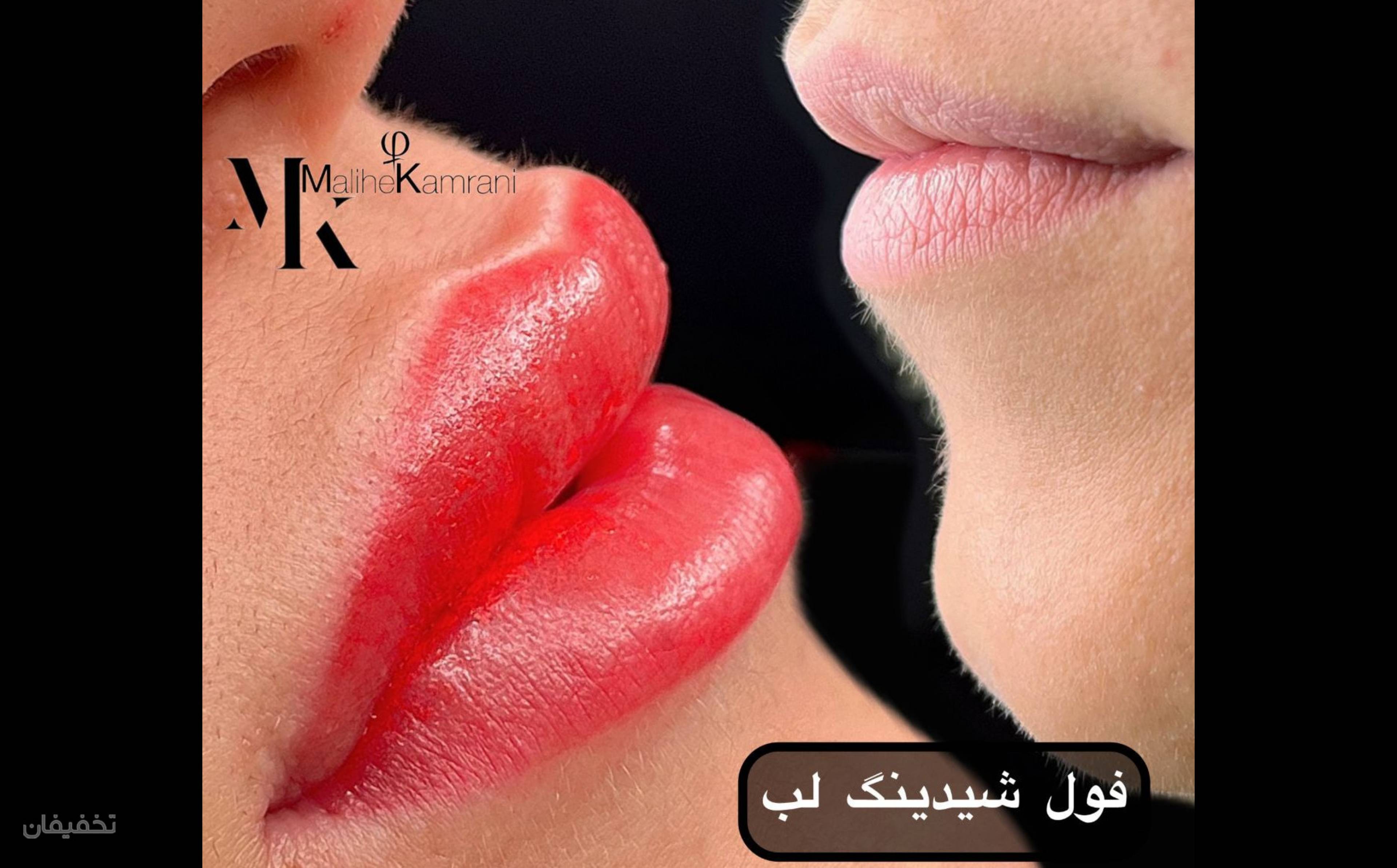ارایش دائم صورت (میکروبلیدینگ ، میکروپیگمنتیشن ، ریموو ، کانتورلب ، کانتورچشم ، میکرواسکالپ)