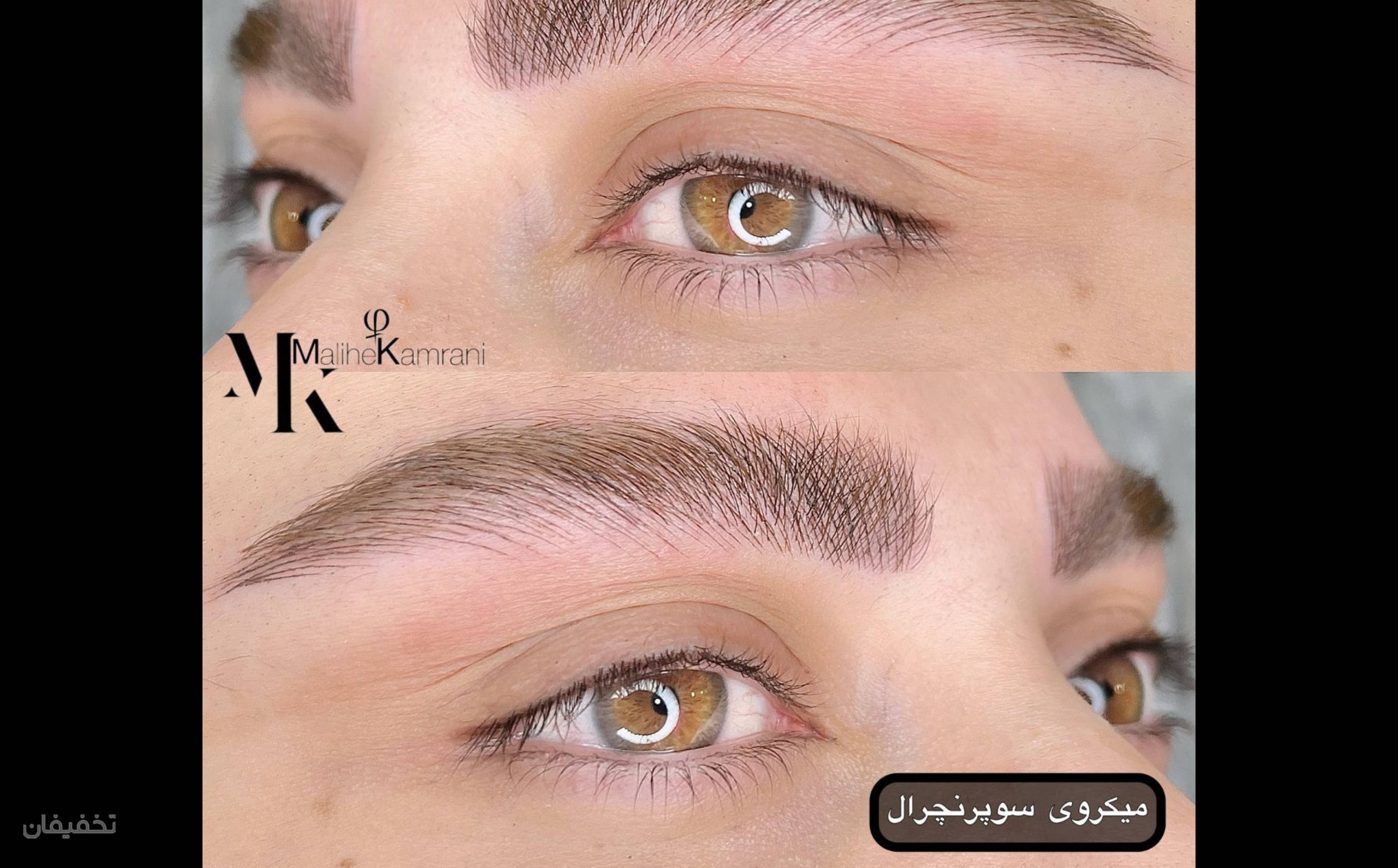 ارایش دائم صورت (میکروبلیدینگ ، میکروپیگمنتیشن ، ریموو ، کانتورلب ، کانتورچشم ، میکرواسکالپ)