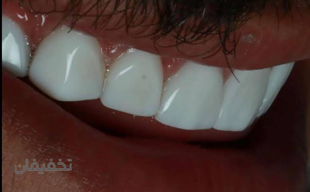 مطب دندانپزشکی خانم دکتر دلارا جهری