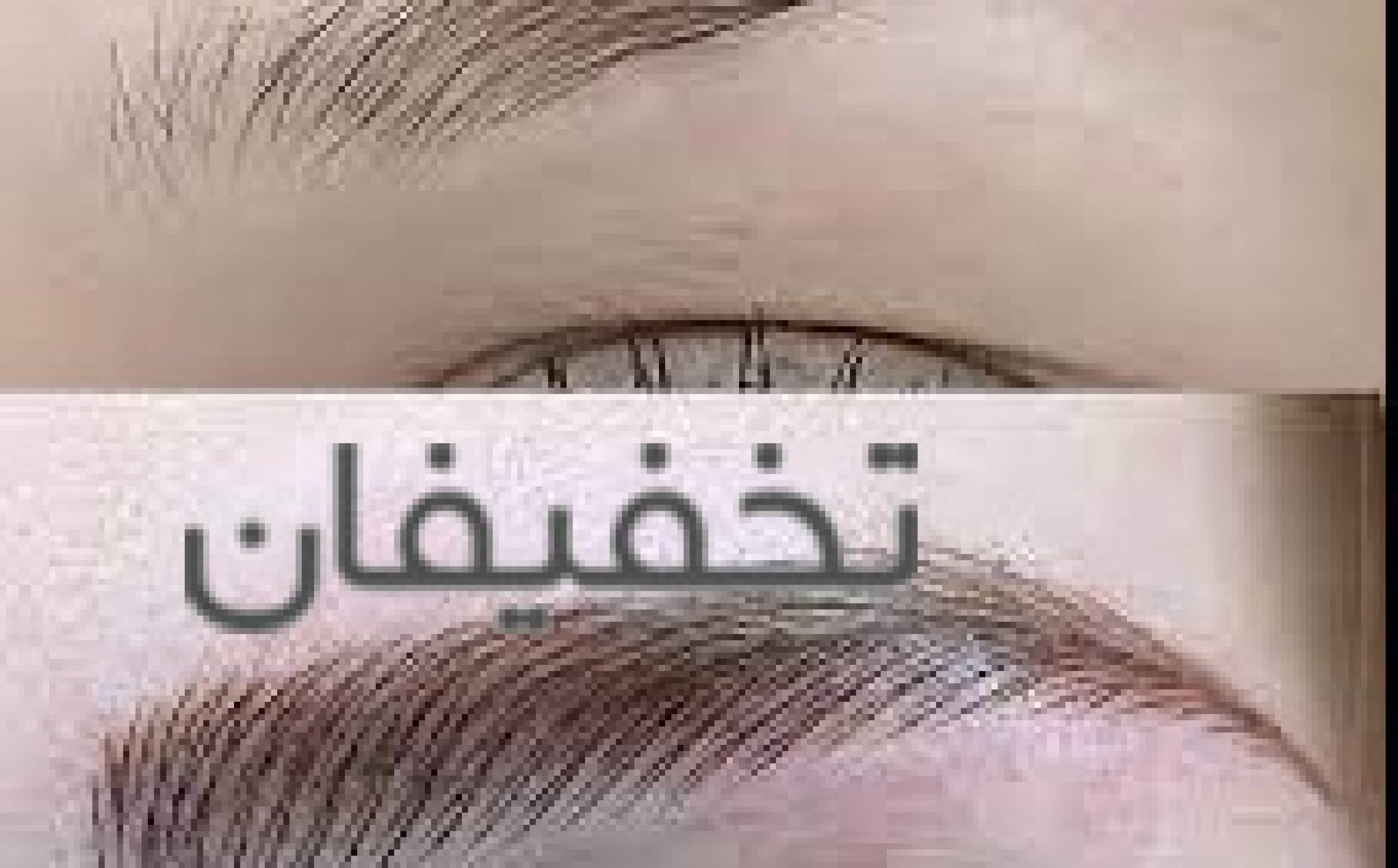 میکروبلیدینگ آلاء