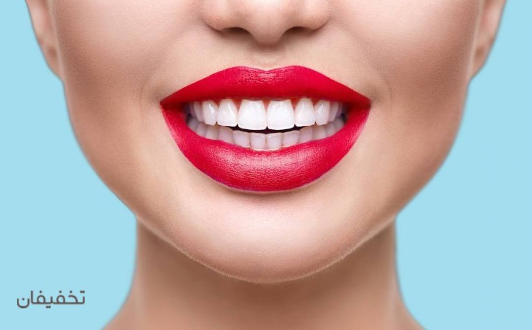 مطب دندانپزشکی دکتر سلیمه لشگری