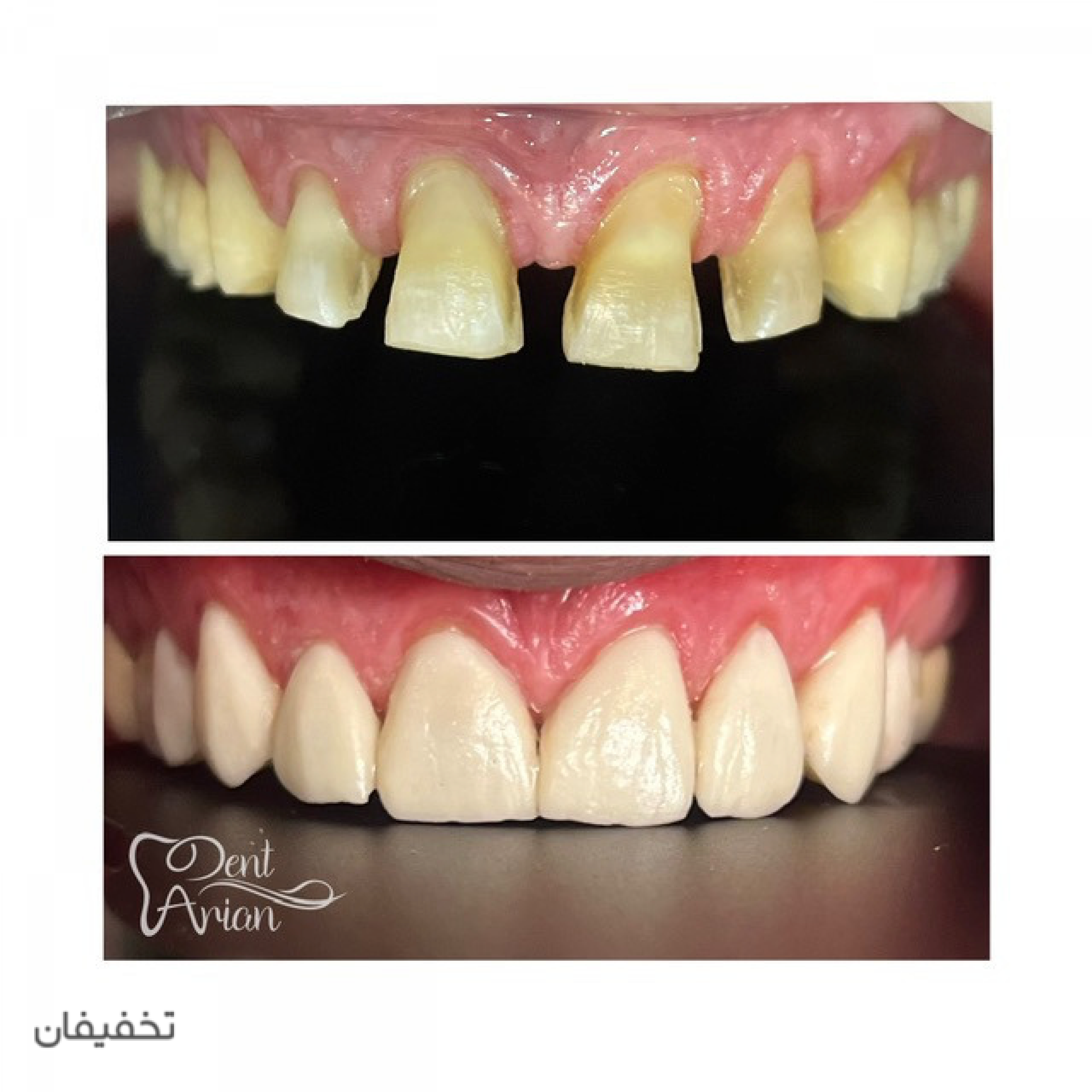 مركز دندانپزشكى دنت آرين