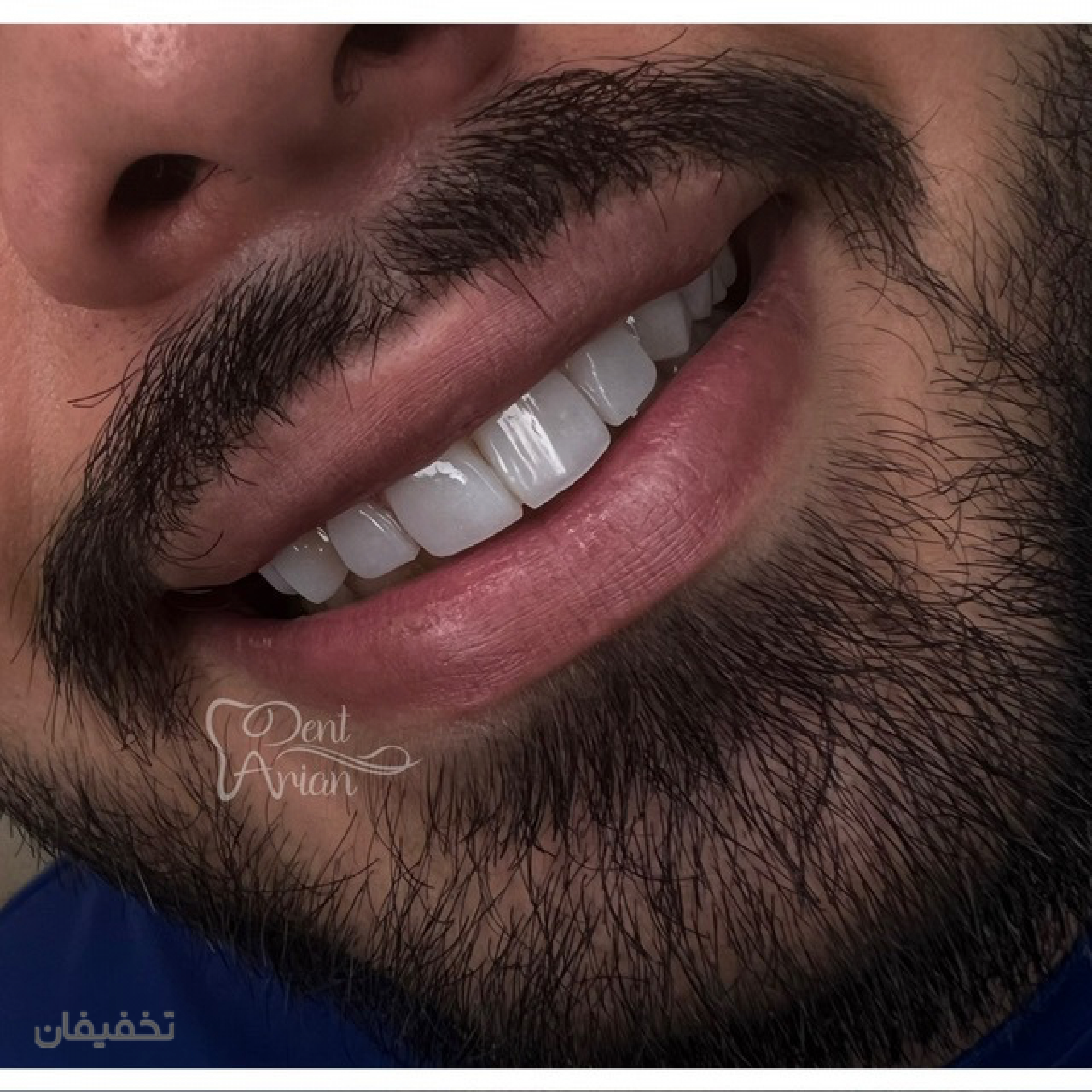 مركز دندانپزشكى دنت آرين